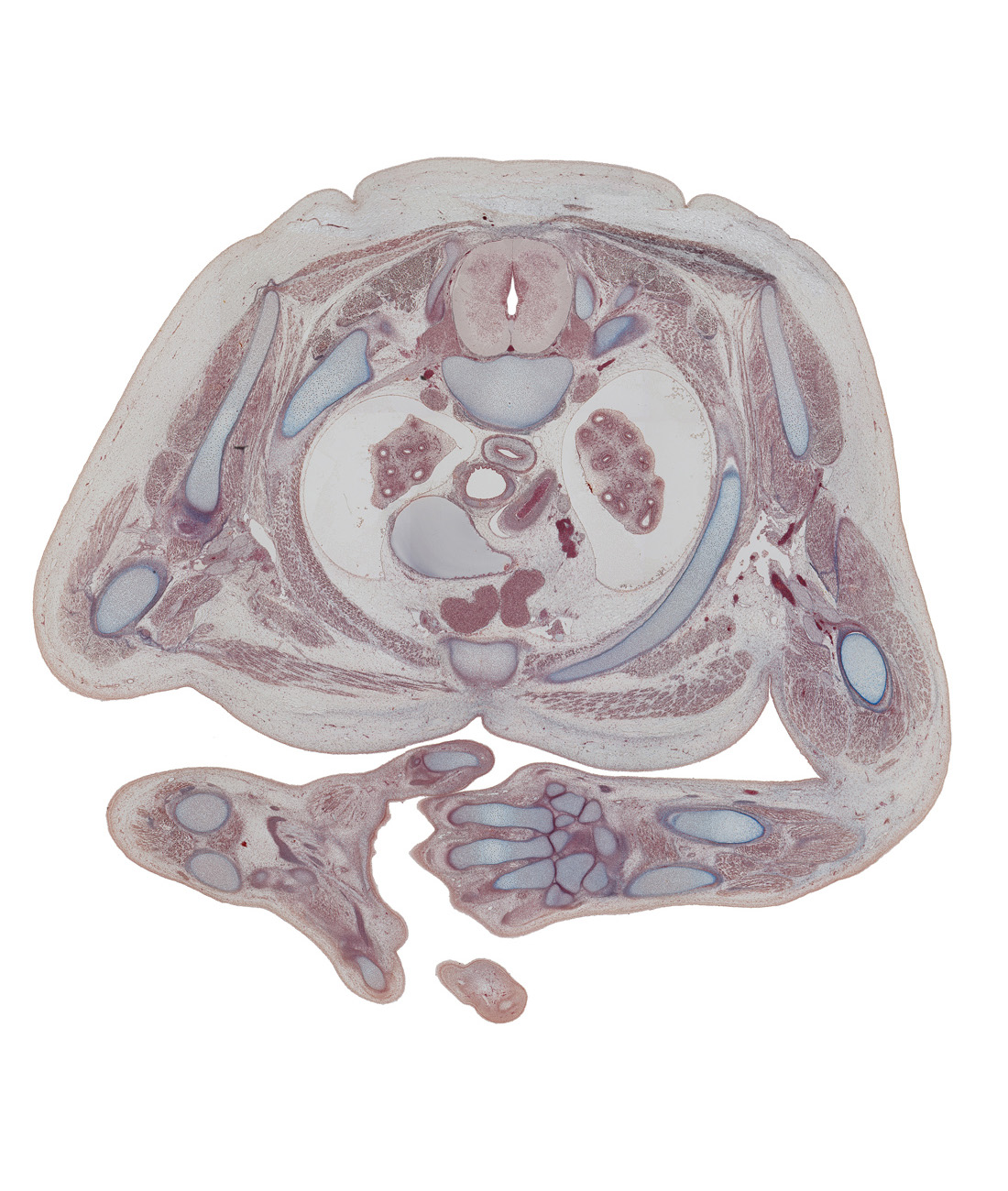 T-2 spinal ganglion, apex of right lung, arch of aorta, brachial artery, head of rib 3, humerus, iliocostalis muscle, left vagus nerve (CN X), longissimus muscle, manubrium of sternum, metacarpal 2, pectoralis major muscle, radius, rhomboid minor muscle, rib 2, right lobe of thymus gland, right phrenic nerve, spinalis muscle, subscapularis muscle, superior vena cava, trapezius muscle, ulna