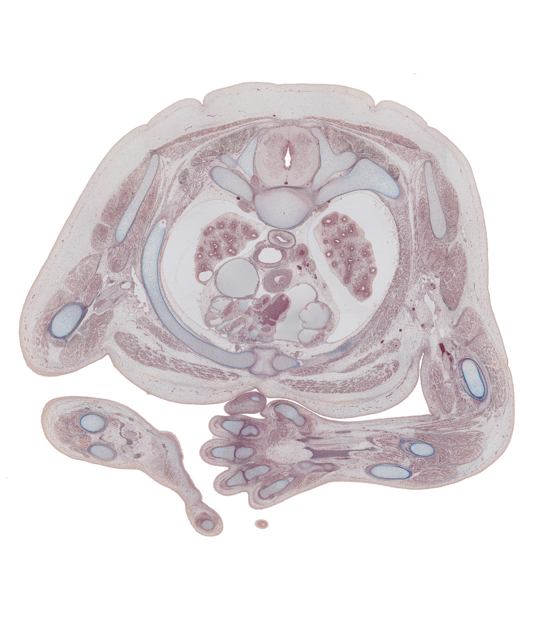 T-2 / T-3 interganglion region, aorta, ascending aorta, biceps brachii muscle, brachialis muscle, edge of left atrium, esophagus, lateral funiculus, lateral horn of grey matter, left vagus nerve (CN X), pectoralis major muscle, pectoralis minor muscle, radial artery, radial nerve, radius, rib 2 (costal cartilage), rib 3, right atrium, superior vena cava, sympathetic trunk, teres major muscle, trachea, triceps brachii muscle, ulna, upper lobe of left lung, upper lobe of right lung