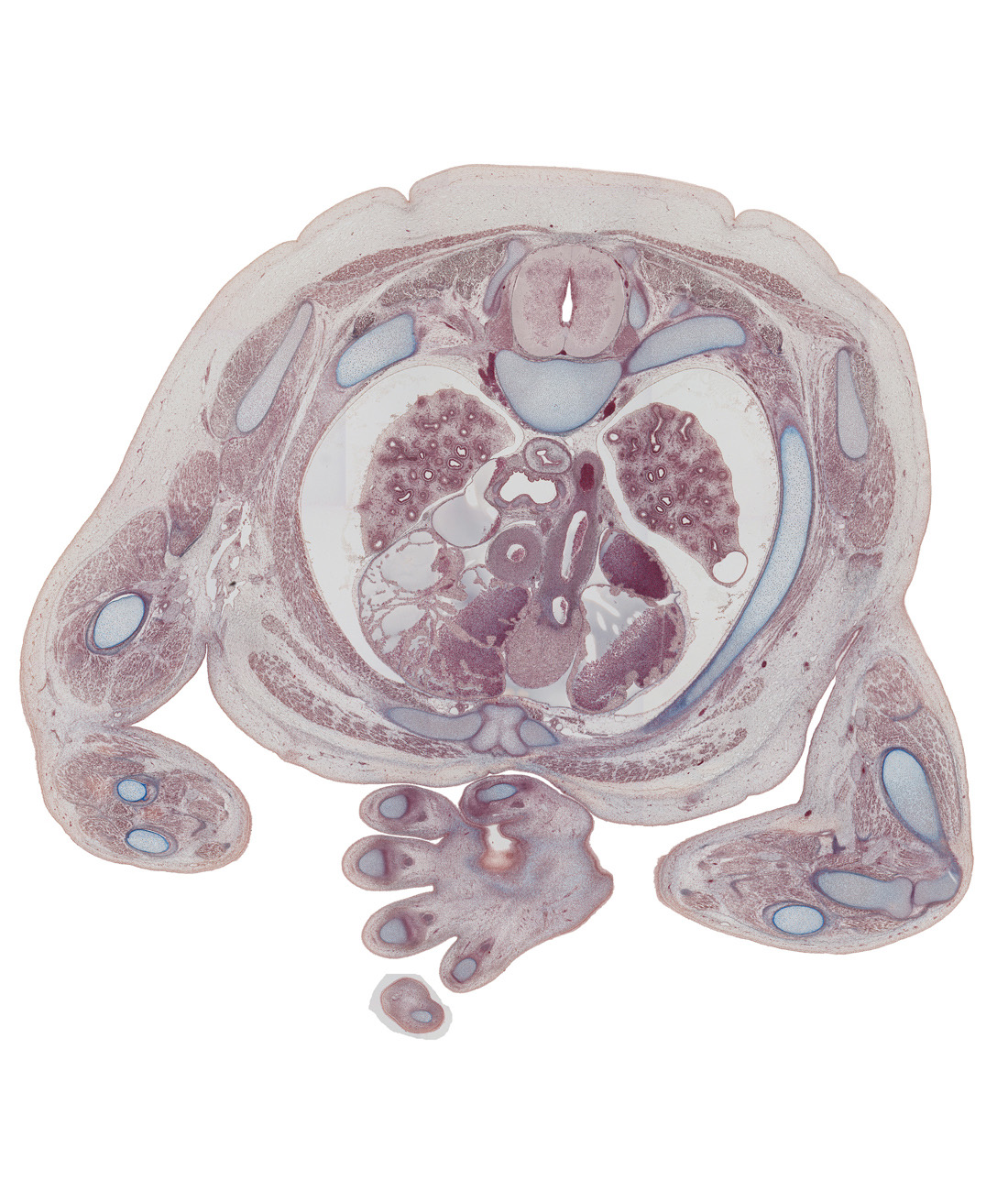 T-3 spinal ganglion, arch of azygos vein, ascending aorta, auricle of left atrium, auricle of right atrium, brachial artery, descending aorta, dorsal horn of grey matter, ductus arteriosus, external intercostal muscle(s), head of radius, humerus, internal intercostal muscle(s), lateral horn of grey matter, left vagus nerve (CN X), palmar aponeurosis, pectoralis major muscle, rhomboid major muscle, rib 3 (costal cartilage), rib 4, right vagus nerve (CN X), scapula, shaft of rib 3, sternocostal muscle, superior vena cava, sympathetic trunk, tracheal bifurcation, ventral horn of grey matter, vestibule of right ventricle