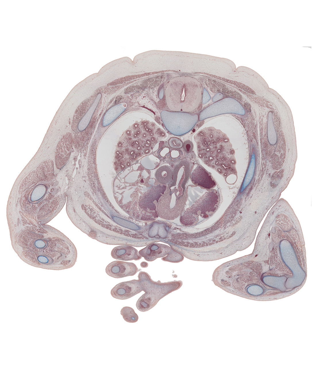 T-3 / T-4 interganglion region, ascending aorta, carina, central canal of spinal cord, centrum of T-4 vertebra, descending aorta, dorsal median septum, ductus arteriosus, extensor hood of digit 4 (ring finger), left atrium, left primary bronchus, median nerve, pectoralis major muscle, pectoralis minor muscle, pulmonary semilunar valve, pulmonary trunk, rib 3, rib 4, right atrium, right primary bronchus, right ventricle, superior vena cava, sympathetic trunk, ulnar nerve, ventral median septum, vestibule