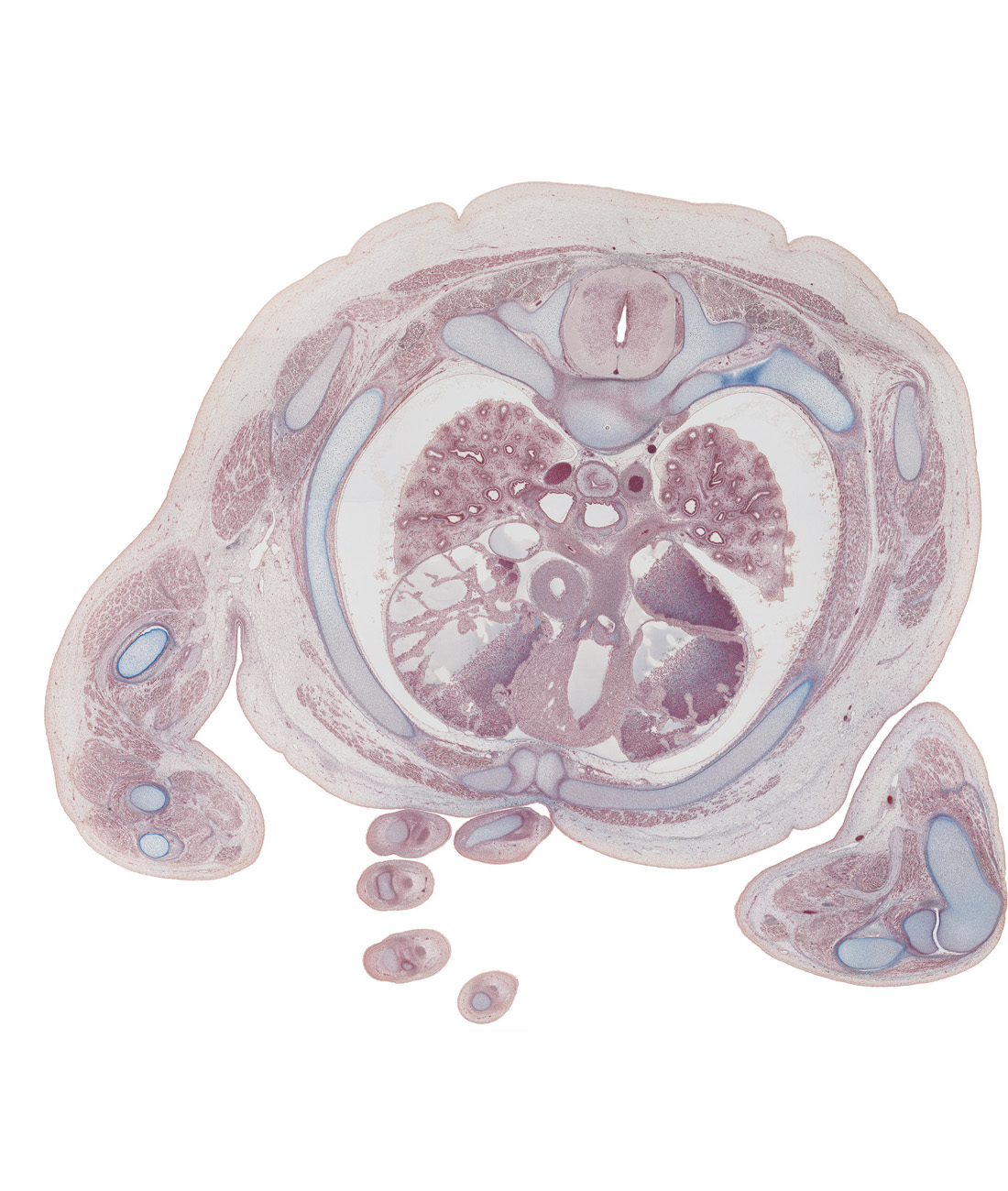 T-3 / T-4 interganglion region, T-3 / T-4 intervertebral disc, aorta, ascending aorta, azygos vein, biceps brachii tendon, iliocostalis muscle, left primary bronchus, left pulmonary artery, longissimus muscle, median nerve, musculi pectinati in right atrial wall, musculi pectinati in wall of left auricle, pulmonary semilunar valve, pulmonary trunk bifurcation, rib 3 (costal cartilage), rib 4, right apical segmental bronchus, right primary bronchus, right pulmonary artery, right upper lobe bronchus, right ventricle, spinalis muscle, superior hemi-azygos vein, ulnar nerve