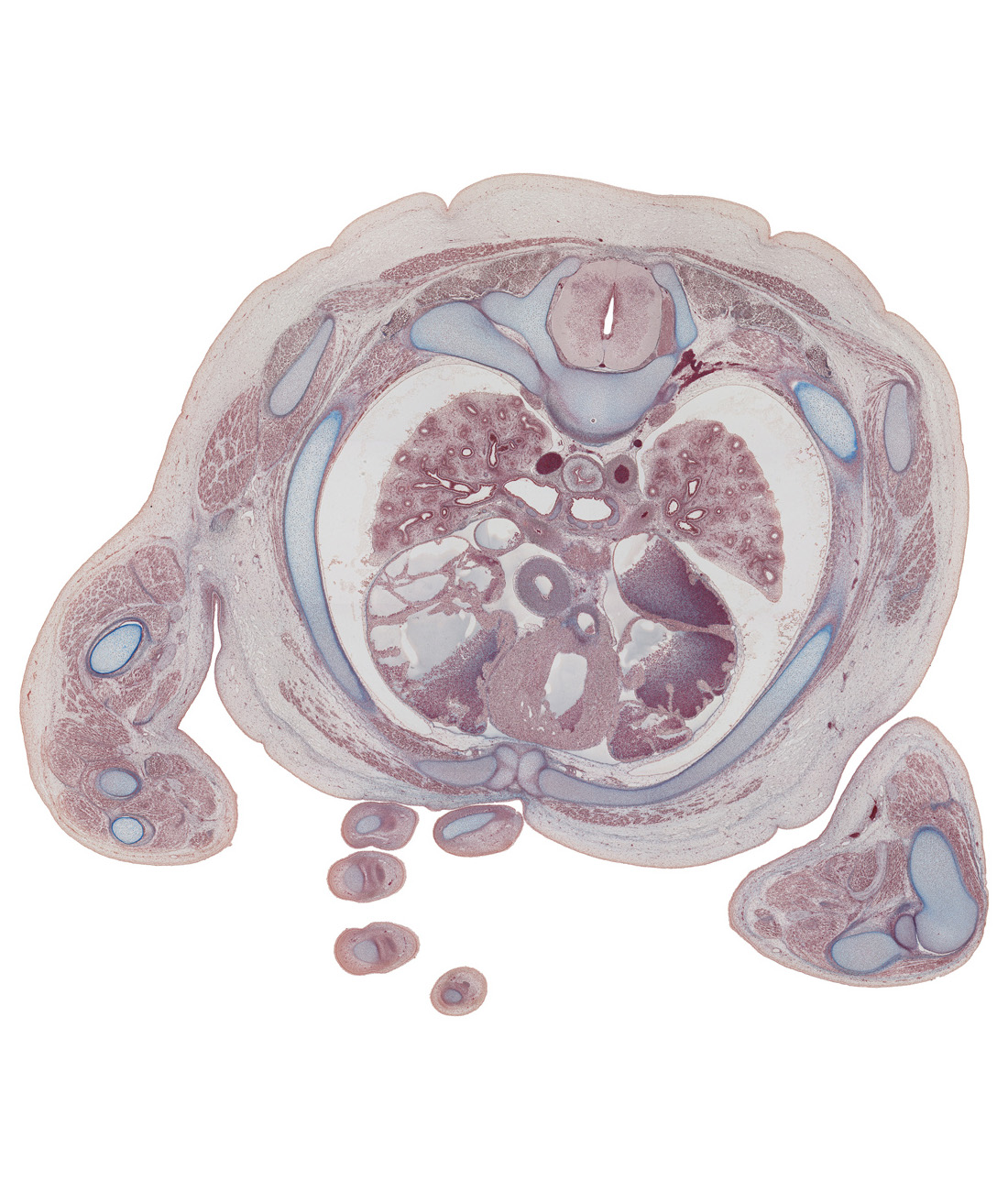 T-4 spinal ganglion, aorta, ascending aorta, azygos vein, dorsal funiculus, esophagus, head of radius, hemisternabra 3, humeroradial joint, infundibulum of right ventricle, lateral funiculus, left atrium, left primary bronchus, pericardial cavity, pleural cavity, proximal radio-ulnar joint, rhomboid major muscle, rib 3 (costal cartilage), rib 4, right anterior segmental bronchus of upper lobe, right atrium, right primary bronchus, sympathetic trunk, tendons of flexor digitorum muscles of digit 4 (ring finger), trapezius muscle, ulna, ulnar nerve, ventral funiculus