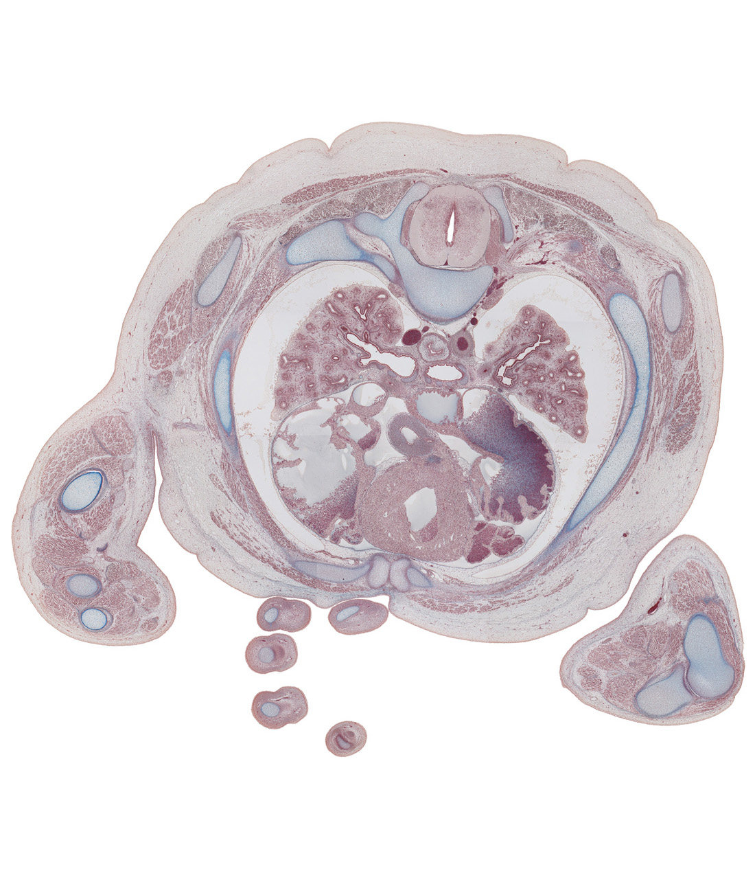 T-4 dorsal primary ramus, T-4 spinal ganglion, T-4 ventral primary ramus (intercostal nerve), aortic semilunar valve, brachial artery, humero-ulnar joint, intermediate phalynx of digit 4 (ring finger), left atrium, left primary bronchus, musculi pectinati, pleural cavity, posterior intercostal artery, rib 3 (costal cartilage), rib 4, right anterior segmental bronchus of upper lobe, right atrium, right posterior segmental bronchus of upper lobe, right primary bronchus, right upper lobe bronchus, right ventricle, sternocostal joint, superior vena cava, transverse pericardial sinus, upper lobe of left lung, upper lobe of right lung