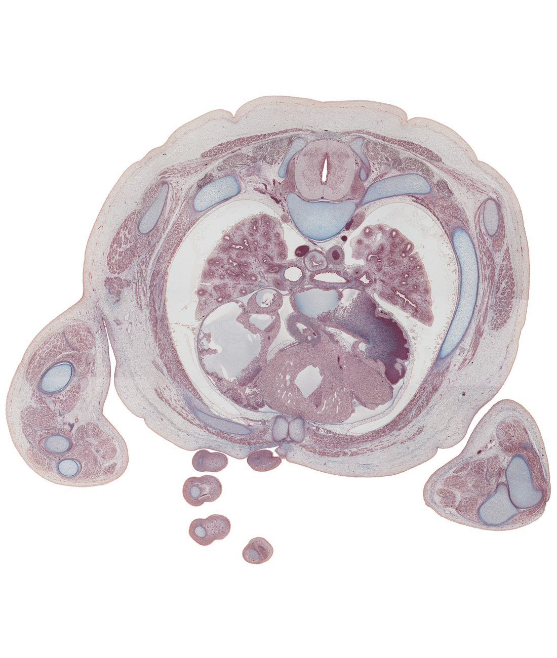 T-4 spinal ganglion, anterior atrioventricular sulcus, aorta, aortic semilunar valve, ascending aorta, azygos vein, central canal, cephalic edge of right ventricle, esophagus, humero-ulnar joint, humerus, left atrium, left primary bronchus, neural arch, pectoralis major muscle, pericardial sac, rib 4, rib 5, right atrium, right primary bronchus, right ventricle, scapula, spinal cord, superior hemi-azygos vein, superior vena cava, sympathetic trunk, transverse pericardial sinus, triceps brachii muscle, upper lobe of left lung, upper lobe of right lung