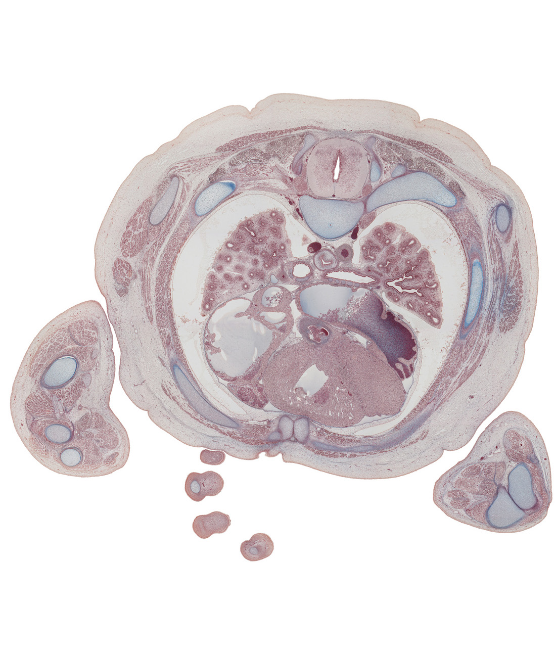 T-4 spinal ganglion, aortic semilunar valve, distal interphalangeal joint of digit 4 (ring finger), humerus, iliocostalis muscle, innermost intercostal muscle(s), left atrium, left upper lobe bronchus, left ventricle, pericardial cavity, pleural cavity, rhomboid major muscle, rib 4, rib 4 (costal cartilage), rib 5, right atrium, right auricle, right coronary artery, right ventricle, spinalis muscle, trapezius muscle, triceps brachii muscle, ulna, upper lobe of left lung, upper lobe of right lung