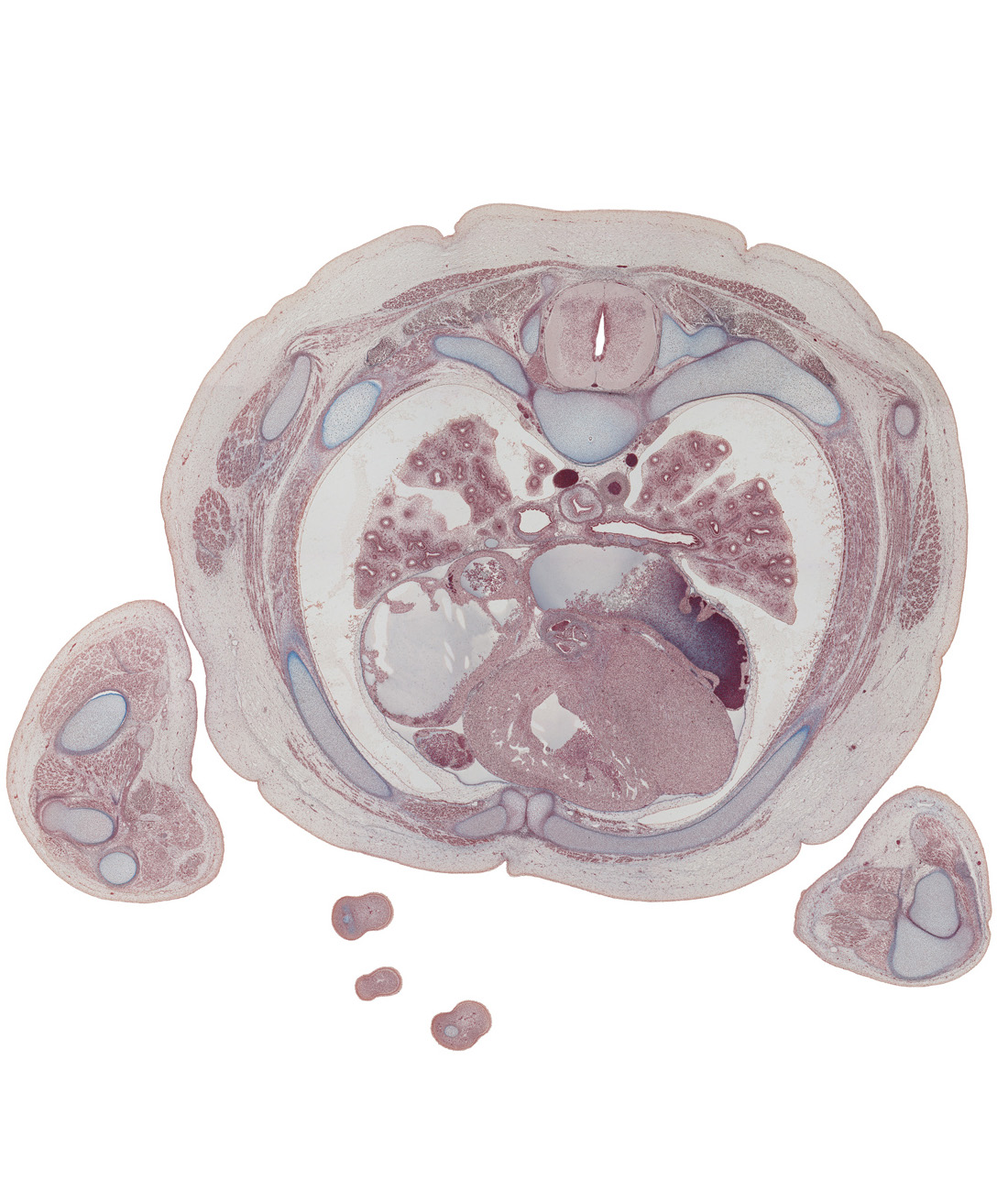 T-4 / T-5 interganglion region, anterior interventricular sulcus, aortic semilunar valve, azygos vein, caudal edge of scapula, edge of distal phalynx of digit 4 (ring finger), external intercostal muscle(s), horizontal fissure, interatrial septum, internal intercostal muscle(s), left atrium, left coronary artery, lower lobe of left lung, lower lobe of right lung, middle lobe of right lung, oblique fissure, rib 4 (costal cartilage), rib 5, serratus anterior muscle, sinus venarum, superior lingular segmental bronchus of left lung, upper lobe of left lung, upper lobe of right lung