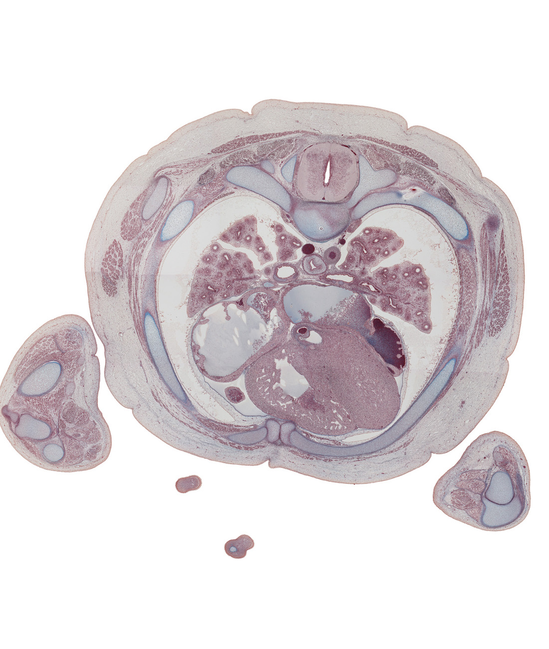 T-4 / T-5 interganglion region, T-4 / T-5 intervertebral disc, anterior interventricular sulcus, aorta, apex of heart, caudal edge of right auricle, caudal edge of scapula, edge of digits (fingers), esophagus, horizontal fissure, humero-ulnar joint, interatrial septum, internal thoracic artery, left atrium, left ventricle, lower lobe of left lung, lower lobe of right lung, middle lobe of right lung, neural arch, oblique fissure, olecranon process of ulna, pericardial sac, posterior intercostal artery, rib 4 (costal cartilage), rib 5, right atrium, sternocostal muscle, trabecular part of right ventricle, transverse process, triceps brachii tendon, ulnar nerve, upper lobe of left lung, upper lobe of right lung