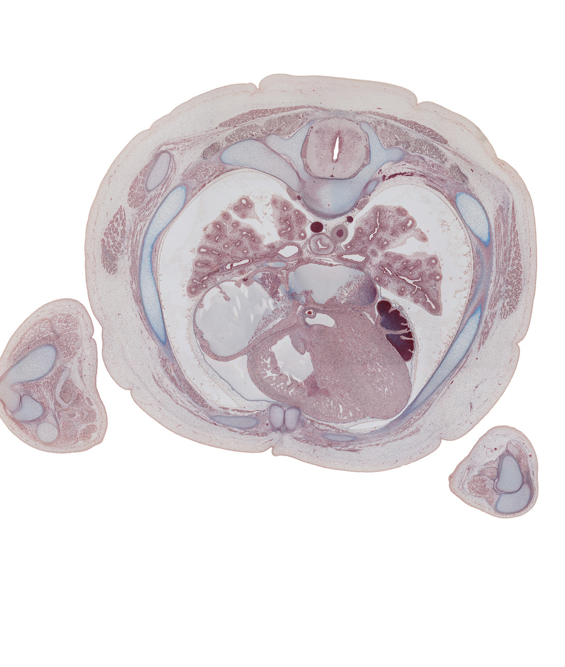 T-4 / T-5 interganglion region, anterior interventricular sulcus, aortic vestibule, azygos vein, central canal of spinal cord, humerus, iliocostalis muscle, inferior lingular segmental bronchus of left lung, left atrium, left ventricle, longissimus muscle, lower lobe of left lung, middle lobe of right lung, neural arch, pericardial cavity, pleural cavity, radius, rib 4, rib 5, right atrium, sinus venarum, spinalis muscle, subcostal muscle, sympathetic trunk, trabecular part of right ventricle, triceps brachii muscle, ulnar nerve