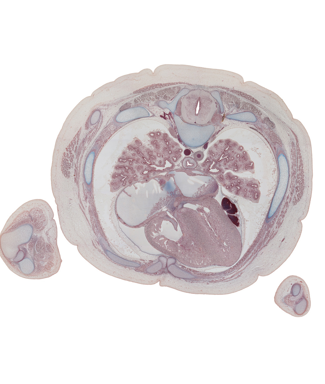 T-5 spinal ganglion, anterior papillary muscle in right ventricle, chorda tendinae, external intercostal muscle(s), internal intercostal muscle(s), interventricular septum, lateral segmental bronchus of middle lobe of right lung, latissimus dorsi muscle, left atrium, lower lobe of left lung, lower lobe of right lung, medial epicondyle of humerus, neural arch, oblique fissure, pericardial cavity, pleural cavity, rib 4 (costal cartilage), rib 5, rib 6, right atrium, right upper pulmonary vein, scapula, ulna, ulnar nerve, upper lobe of left lung, valve of foramen ovale