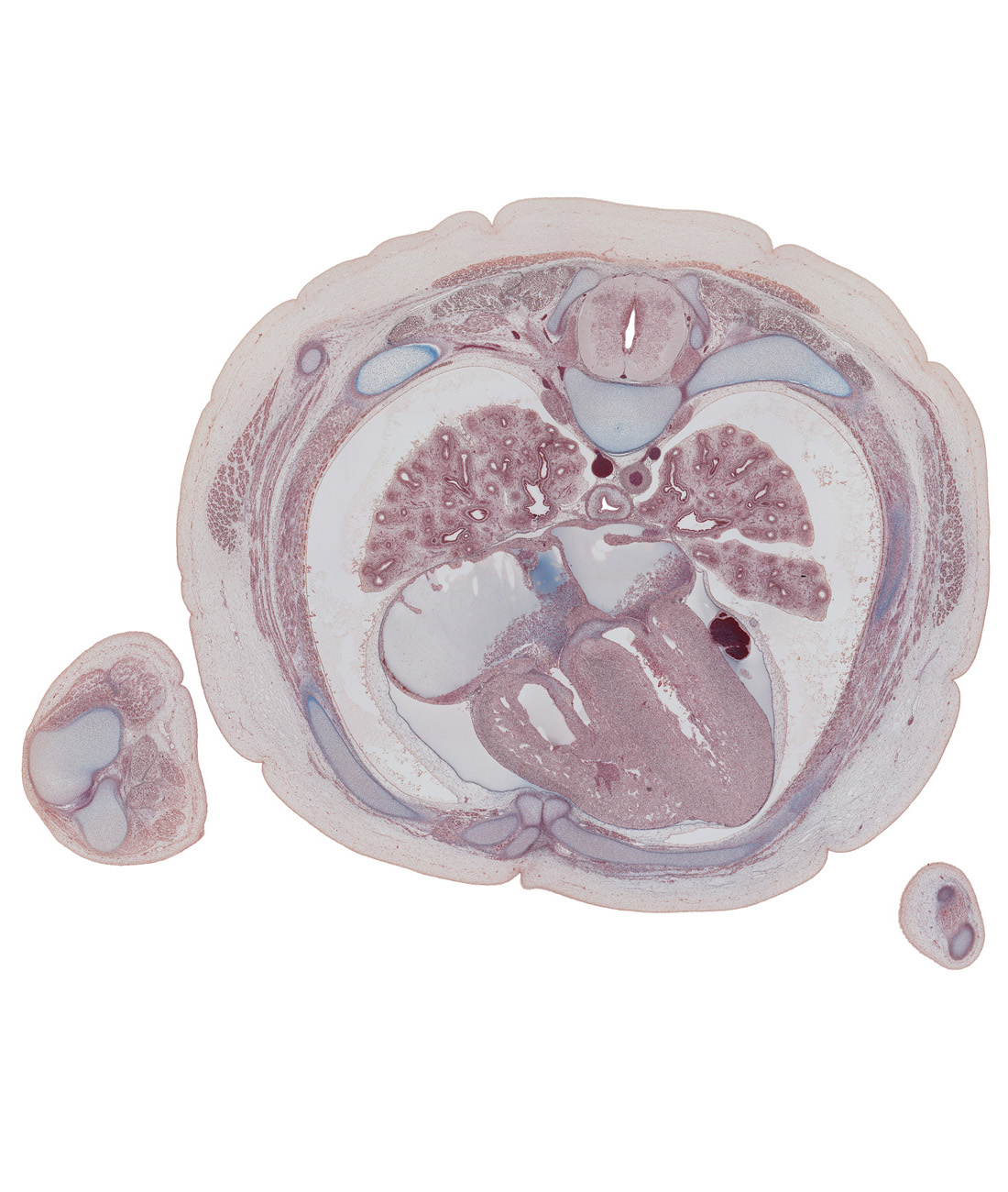 T-5 spinal ganglion, anterior interventricular sulcus, anterior papillary muscle in left ventricle, atrioventricular sulcus, caudal edge of scapula, left atrium, left upper pulmonary vein, left ventricle, lower lobe of left lung, lower lobe of right lung, middle lobe of right lung, muscular part of interventricular septum, oblique fissure, pericardial cavity, pleural cavity, rib 5 (costal cartilage), rib 6, right atrium, right upper pulmonary vein, right ventricle, serratus anterior muscle, sternocostal muscle, sympathetic trunk, trapezius muscle, upper lobe of left lung