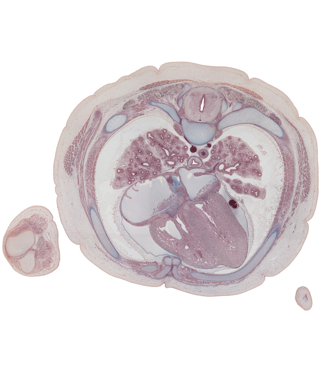 T-5 spinal ganglion, anterior papillary muscle in right ventricle, caudal edge of left auricle, dorsal median septum, edge of elbow, hemisternum, humerus, interatrial septum, left lower pulmonary vein, lower lobe of left lung, lower lobe of right lung, membranous part of interventricular septum, middle lobe of right lung, oblique fissure, pia mater on surface of spinal cord, rib 5 (costal cartilage), rib 6, rib 6 (costal cartilage), right atrium, sympathetic trunk, trapezius muscle, ulna, upper lobe of left lung, ventral median septum