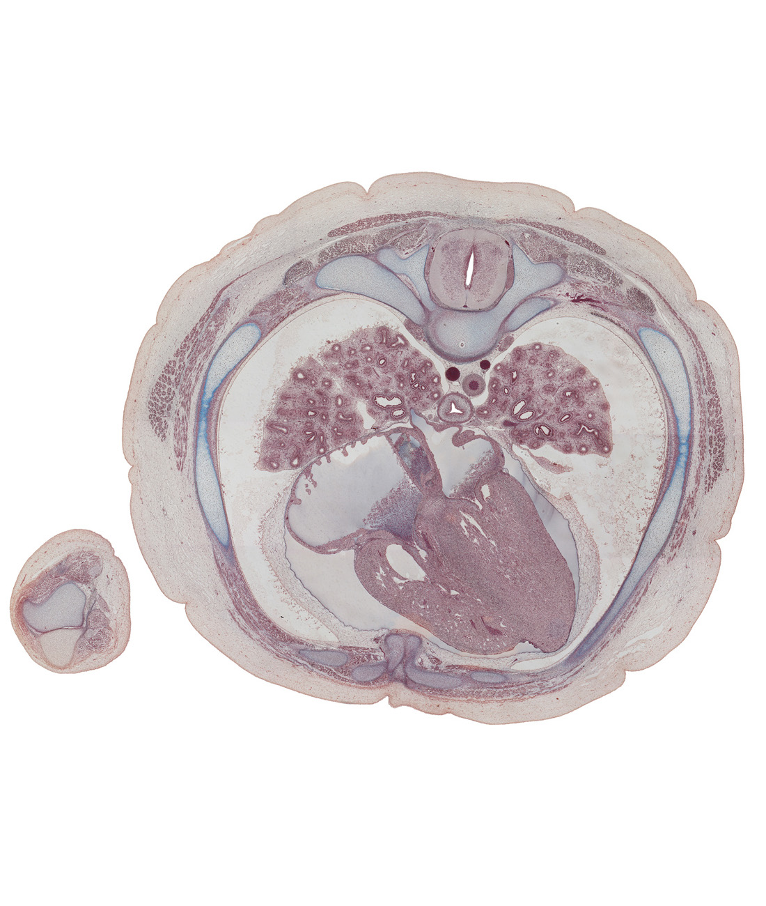 T-5 / T-6 interganglion region, anterior papillary muscle in right ventricle, aorta, apex of heart, azygos vein, body of rib 6, central canal, esophagus, head of rib 6, intrasternal joint, left atrium, left lower pulmonary vein, left ventricle, lower lobe of right lung, middle lobe of right lung, pericardial cavity, rib 5 (costal cartilage), rib 6 (costal cartilage), right atrioventricular (tricuspid) valve, right atrium, right lower pulmonary vein, right ventricle, septal papillary muscle, spinal cord, superior hemi-azygos vein