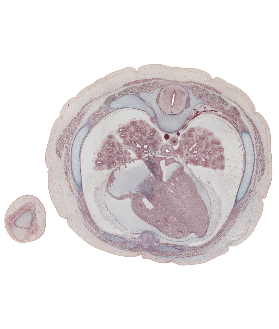 T-6 spinal ganglion, anterior interventricular sulcus, aorta, azygos vein, centrum of T-6 vertebra, dorsal horn of grey matter, esophagus, interatrial septum, lateral horn of grey matter, left atrioventricular (mitral) valve, left atrium, left ventricle, lower lobe of left lung, lower lobe of right lung, middle lobe of right lung, oblique fissure, pericardial cavity, rib 6, rib 6 (costal cartilage), right atrioventricular (tricuspid) valve, right atrium, right lower pulmonary vein, right ventricle, trapezius muscle, ventral horn of grey matter