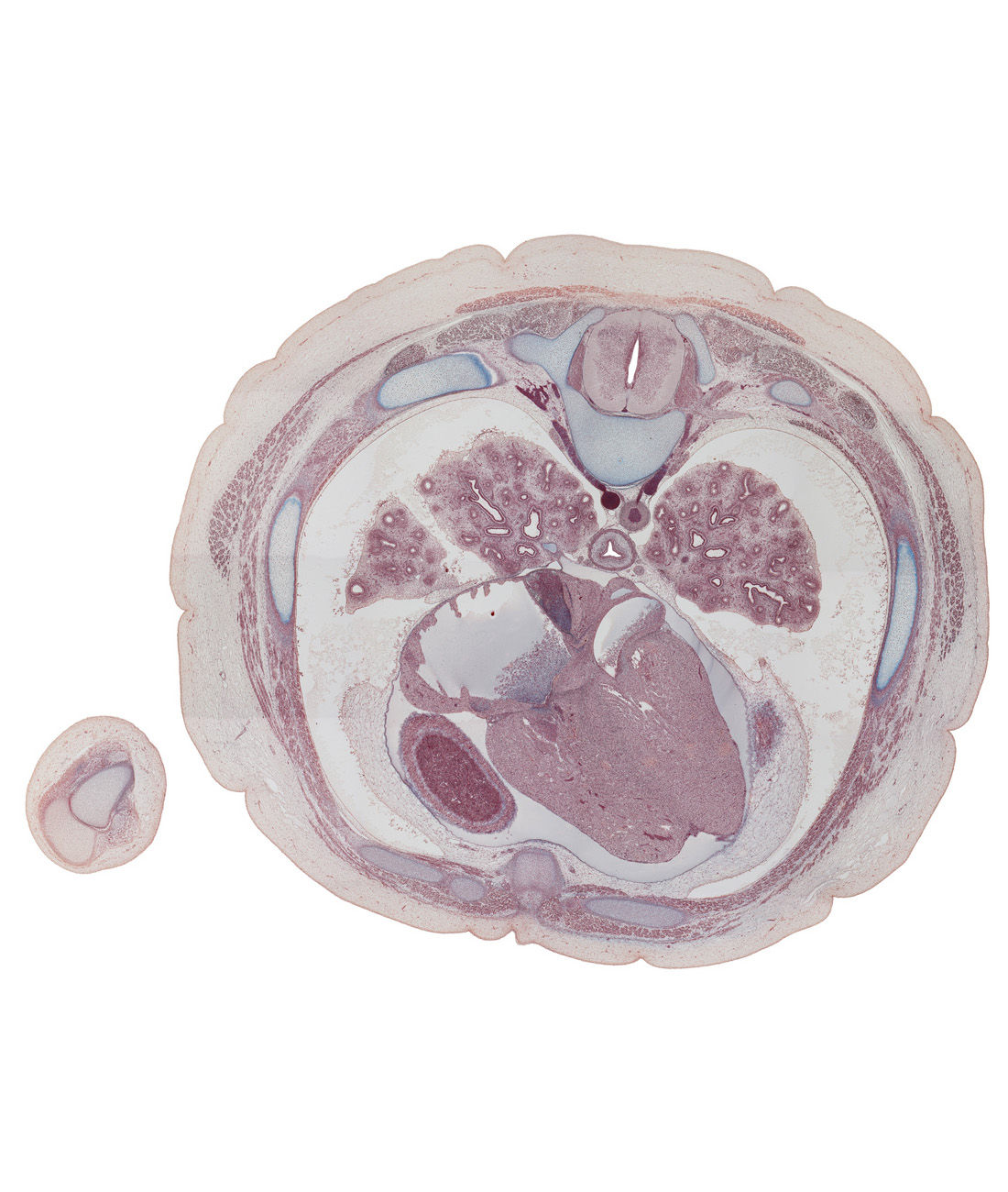 T-6 spinal ganglion, T-6 spinal nerve, central canal of spinal cord, centrum of T-6 vertebra, diaphragm, edge of diaphragm, edge of left lobe of liver, edge of right lobe of liver, iliocostalis muscle, latissimus dorsi muscle, left phrenic nerve, longissimus muscle, musculi pectinati, pericardial cavity, pleural cavity, posterior intercostal vein, posterior papillary muscle, rib 6, rib 6 (costal cartilage), right atrium, serratus anterior muscle, spinalis muscle, trapezius muscle, tubercle of rib 7, xiphisternal joint