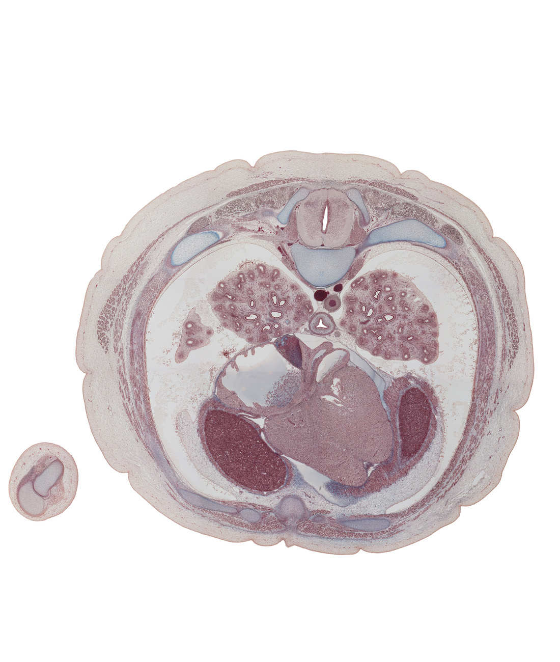 T-6 spinal ganglion, anterior rectus sheath, aorta, coronary sinus, esophagus, inferior vena cava, interventricular sulcus, latissimus dorsi muscle, left atrioventricular (mitral) valve, lower lobe of left lung, lower lobe of right lung, middle lobe of right lung, oblique fissure, pericardial cavity, posterior papillary muscle, rectus abdominis muscle, rib 6 (costal cartilage), rib 7, right atrium, serratus anterior muscle, sympathetic trunk, xiphoid