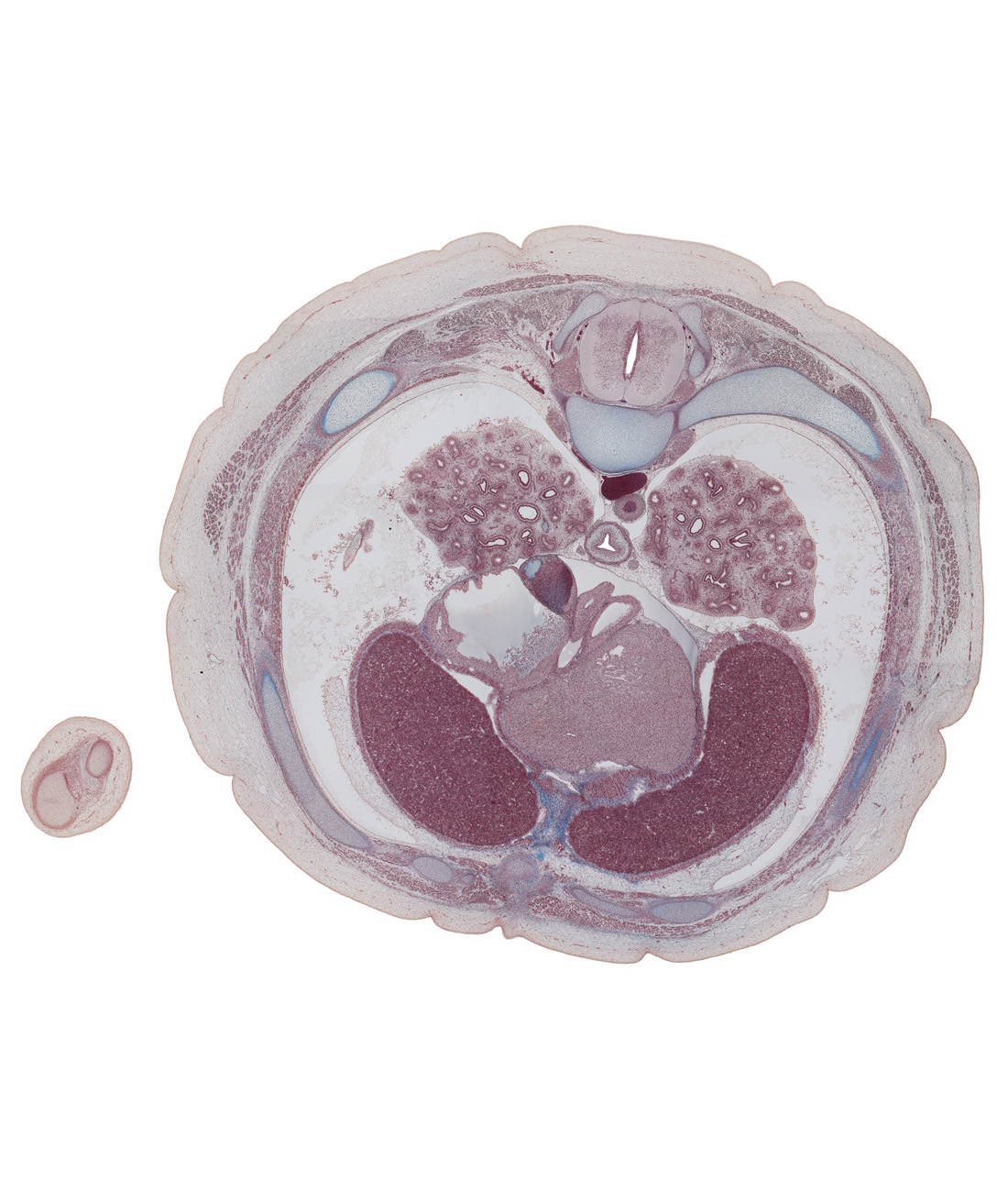 T-6 spinal ganglion, anastomosis between azygos and hemi-azygos veins, aorta, atrioventricular sulcus, caudal edge of left atrium, caudal edge of middle lobe of right lung, centrum of T-7 vertebra, costodiaphragmatic recess, iliocostalis muscle, inferior vena cava, interventricular sulcus, left vagus nerve (CN X), longissimus muscle, loose connective tissue, lower lobe of right lung, pericardial cavity, rectus abdominis muscle, rib 7, right atrium, spinalis muscle, subcutaneous tissue, xiphoid