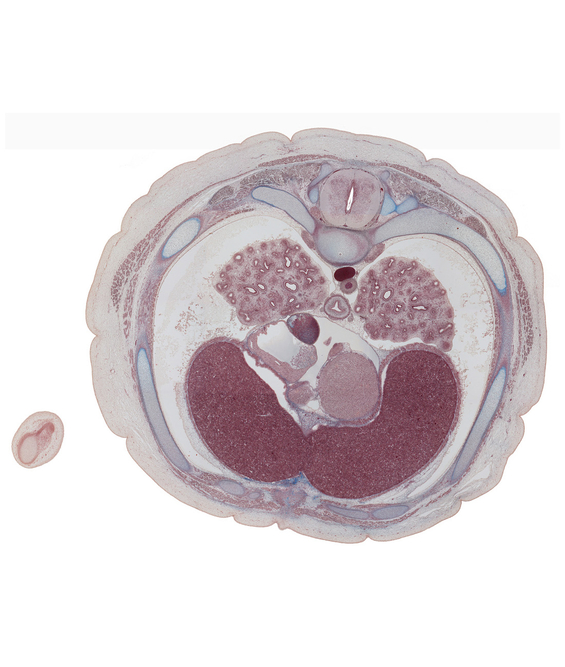 T-6 / T-7 interganglion region, anastomosis between azygos and hemi-azygos veins, aorta, caudal edge of right ventricle, costodiaphragmatic recess, esophagus, inferior vena cava, interventricular sulcus, left lobe of liver, left vagus nerve (CN X), left ventricle, lower lobe of right lung, oblique sinus of pericardial cavity, pericardial sac, rib 7, rib 7 (costal cartilage), right atrium, right elbow, right lobe of liver, right vagus nerve (CN X)