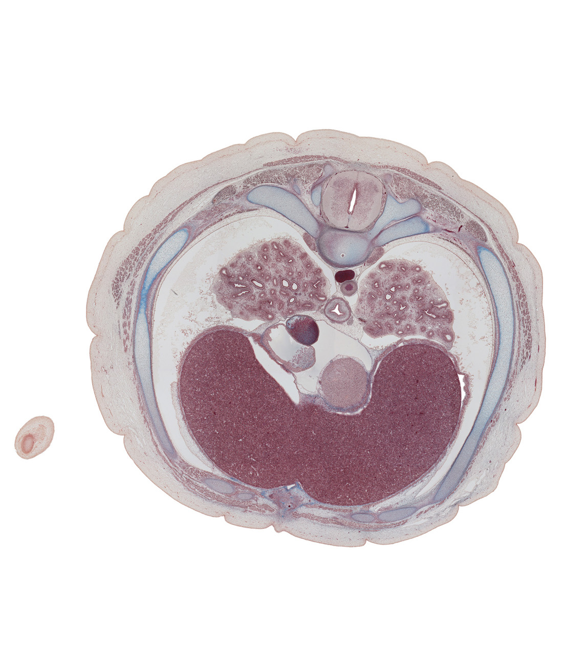 T-6 / T-7 interganglion region, T-6 / T-7 intervertebral disc, central tendon of diaphragm, costodiaphragmatic recess, head of rib 7, inferior vena cava, latissimus dorsi muscle, left lobe of liver, left vagus nerve (CN X), left ventricle, lower lobe of left lung, lower lobe of right lung, notochord, pericardial cavity, posterior intercostal artery, rectus abdominis muscle, rib 7, right atrium, right lobe of liver, serratus anterior muscle, sympathetic trunk, thoracolumbar fascia, trapezius muscle