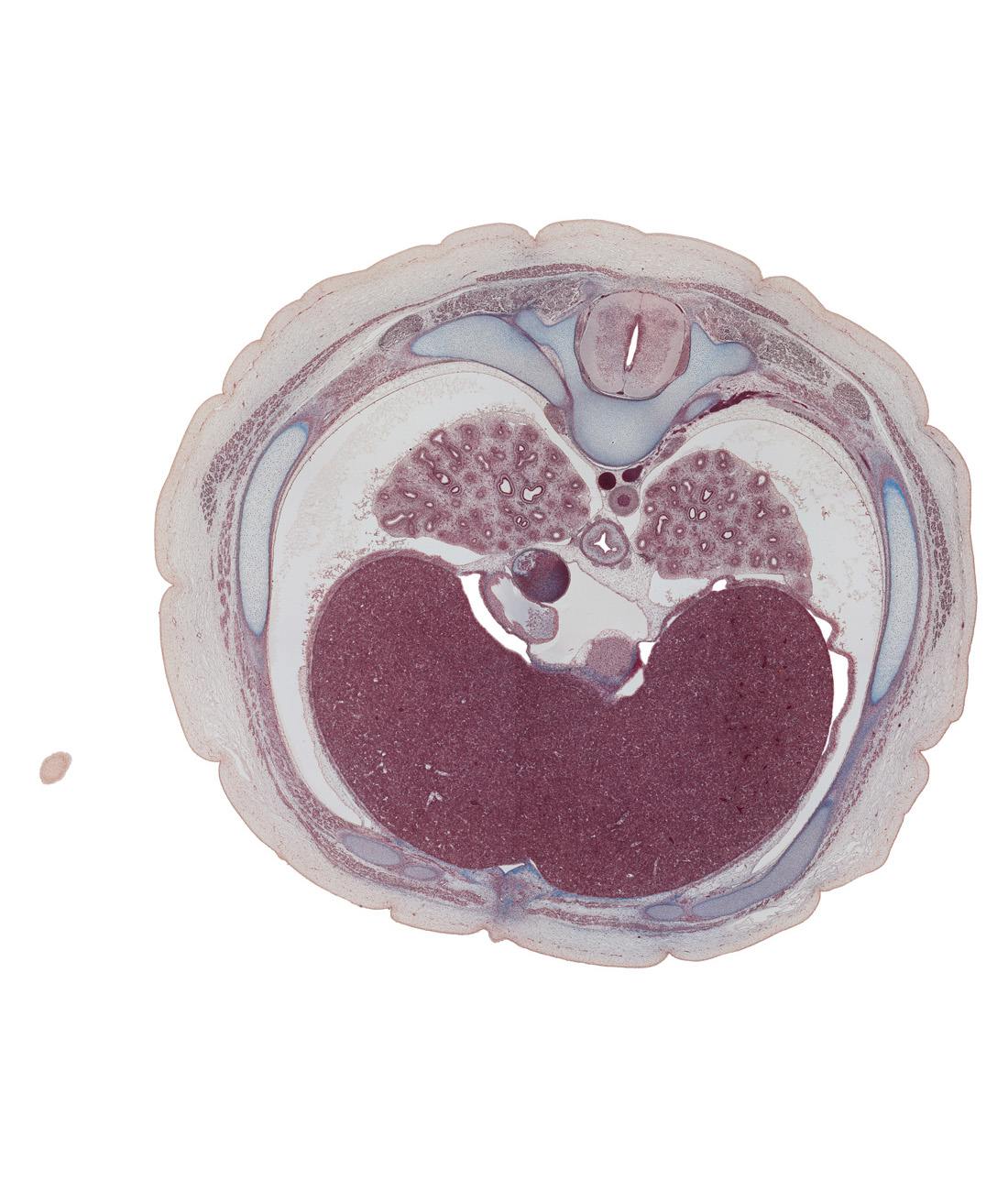 T-7 spinal ganglion, anterior spinal artery, aorta, azygos vein, caudal edge of left ventricle, caudal part of right atrium, costal margin, costodiaphragmatic recess, esophagus, inferior hemi-azygos vein, inferior vena cava, lower lobe of left lung, lower lobe of right lung, pericardial cavity, peritoneal cavity, pleural cavity, posterior spinal artery, rectus abdominis muscle, rib 7, right vagus nerve (CN X), transverse process of T-7 vertebra, xiphoid