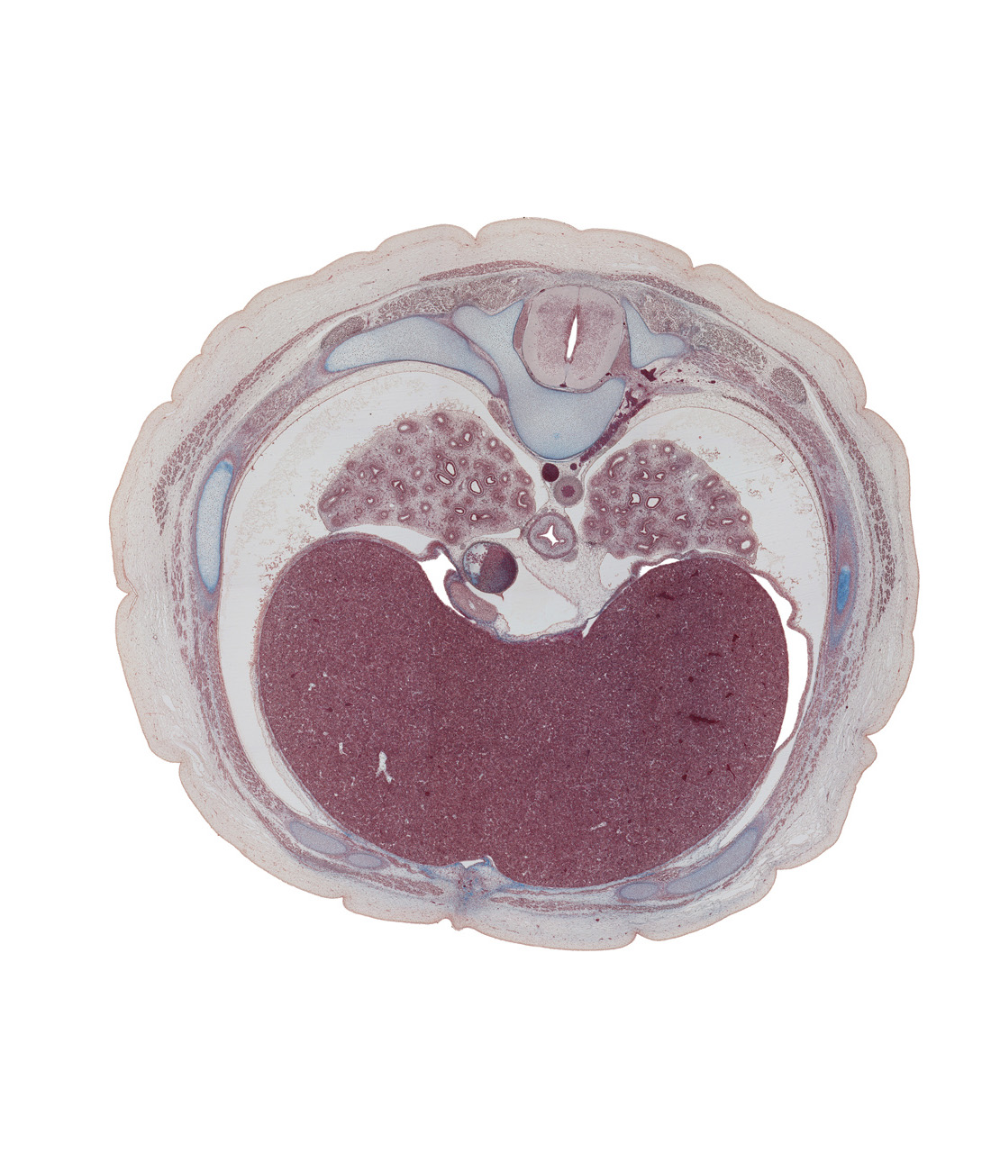 T-7 spinal ganglion, aorta, caudal edge of right atrium, costal margin, diaphragm, esophageal nerve plexus, greater splanchnic ramus, inferior vena cava, left lobe of liver, linea alba, pericardial cavity, pleural cavity, rectus abdominis muscle, rib 7, right lobe of liver, sympathetic trunk