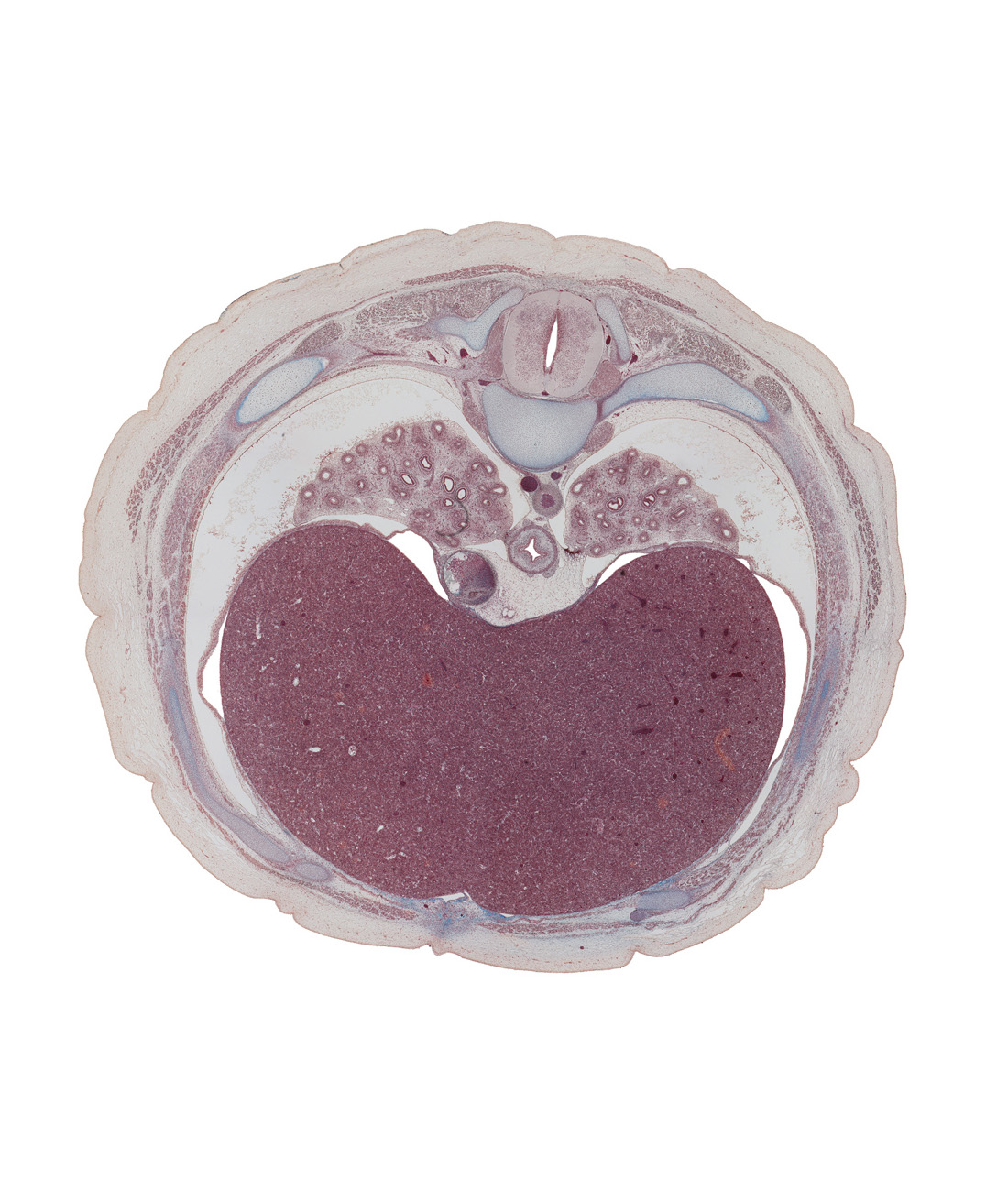 T-7 spinal ganglion, caudal edge of pericardial cavity, dorsal horn of grey matter, iliocostalis muscle, inferior vena cava, lateral horn of grey matter, latissimus dorsi muscle, left lobe of liver, linea alba, longissimus muscle, lower lobe of left lung, lower lobe of right lung, parietal pleura, peritoneal cavity, pleural cavity, rib 8, right lobe of liver, serratus anterior muscle, spinalis muscle, trapezius muscle, ventral horn of grey matter