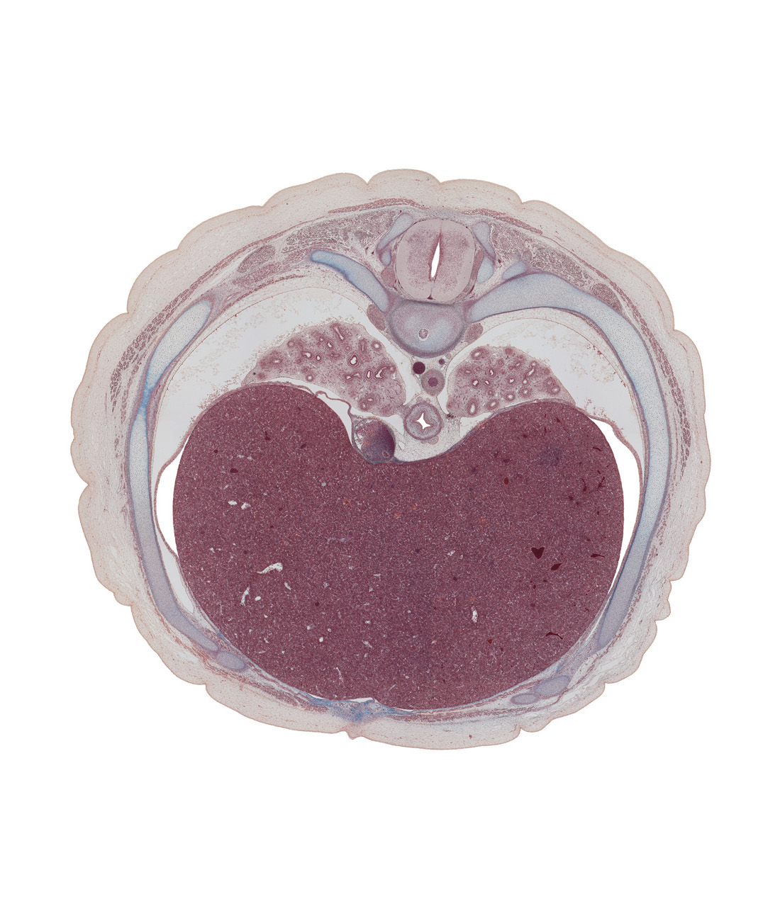 T-7 / T-8 interganglion region, T-7 / T-8 intervertebral disc, anterior spinal artery, central tendon of diaphragm, costal margin, costotransverse joint, diaphragm, inferior vena cava, left lobe of liver, left vagus nerve (CN X), lower lobe of left lung, lower lobe of right lung, notochord, peritoneal cavity, pleural cavity, rib 8, right lobe of liver, right vagus nerve (CN X), sympathetic trunk