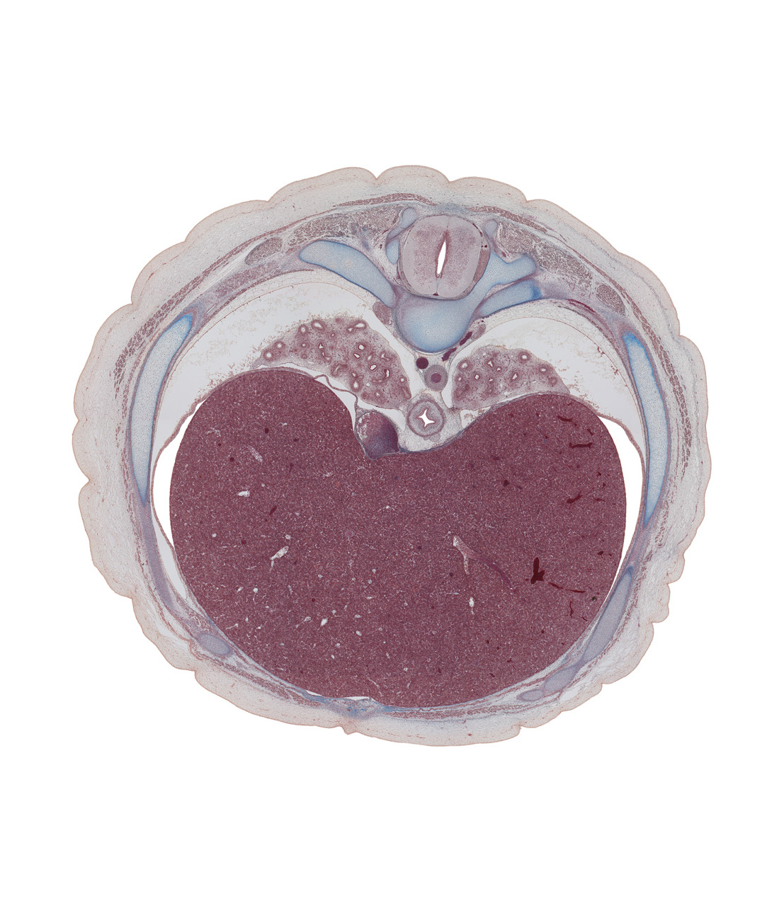 T-8 spinal ganglion, azygos vein, body of rib 8, dorsal funiculus, head of rib 8, inferior vena cava, lateral funiculus, left lobe of liver, lower lobe of left lung, lower lobe of right lung, neural arch, pedicle, pulmonary ligament, rib 8 (costal cartilage), right lobe of liver, sympathetic trunk, transverse process, trapezius muscle, ventral funiculus