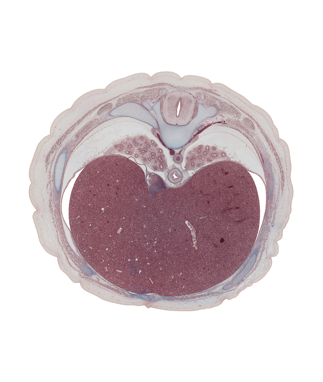 T-8 spinal ganglion, aorta, azygos vein, costal margin, esophagus, inferior vena cava, left lobe of liver, linea alba, lower lobe of left lung, lower lobe of right lung, posterior intercostal artery, posterior intercostal vein, posterior spinal artery, rectus abdominis muscle, rib 8, right lobe of liver, right phrenic nerve, tributary of left hepatic vein