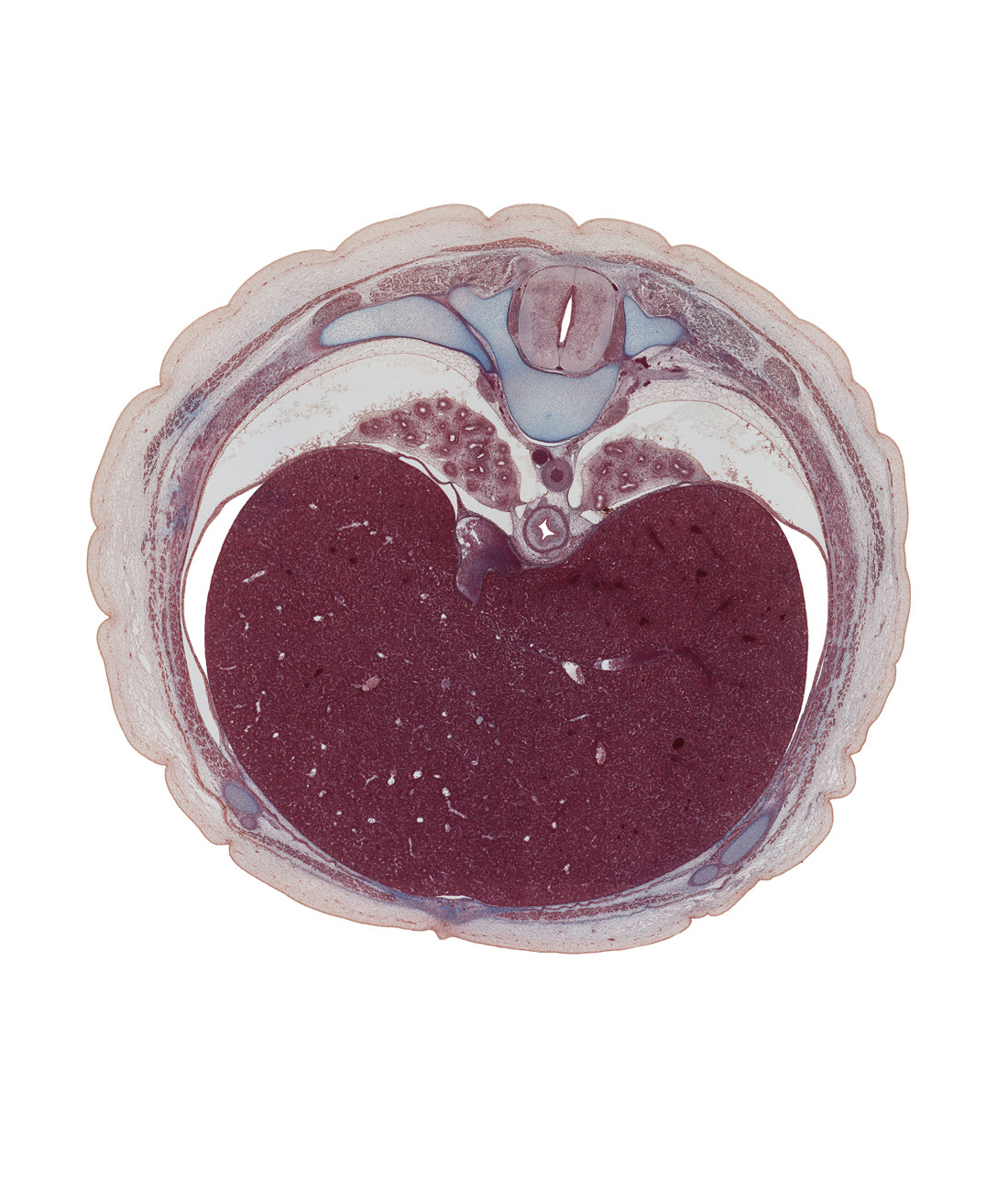 T-8 spinal ganglion, anterior gastric nerve (CN X), anterior rectus sheath, common hepatic vein, costal margin, esophagus, external intercostal muscle(s), iliocostalis muscle, inferior vena cava, innermost intercostal muscle(s), internal intercostal muscle(s), left lobe of liver, longissimus muscle, posterior gastric nerve (CN X), pulmonary ligament, rectus abdominis muscle, right lobe of liver, spinalis muscle, transverse process, transversospinalis muscle, trapezius muscle, tributaries of left hepatic vein