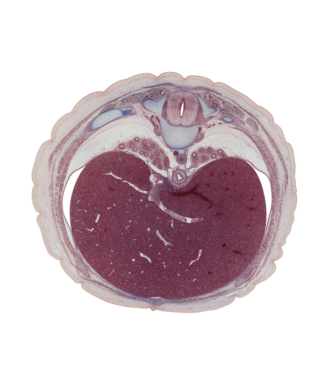 T-8 spinal ganglion, T-8 spinal nerve, aorta, central canal of spinal cord, diaphragm, dorsal funiculus, dorsal median septum, esophagus, latissimus dorsi muscle, left hepatic vein, left lobe of liver, linea alba, loose connective tissue, pedicle of T-8 vertebra, peritoneal cavity, pleural cavity, right lobe of liver, subcutaneous tissue, sympathetic trunk, tributary of right hepatic vein