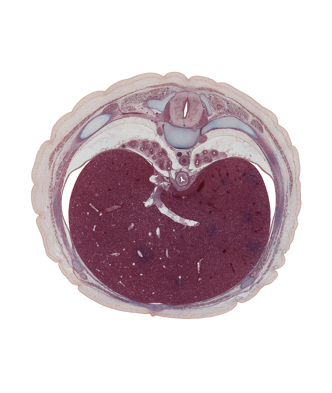 T-8 spinal ganglion, anterior spinal artery, azygos vein, common hepatic vein, costal margin, dorsal horn of grey matter, dorsal meso-esophagus, inferior vena cava, junction of ductus venosus and inferior vena cava, lateral horn of grey matter, left hepatic vein, left lobe of liver, linea alba, lower lobe of left lung, lower lobe of right lung, pulmonary ligament, rectus abdominis muscle, rib 9, right hepatic vein, serratus anterior muscle, sympathetic trunk, ventral horn of grey matter