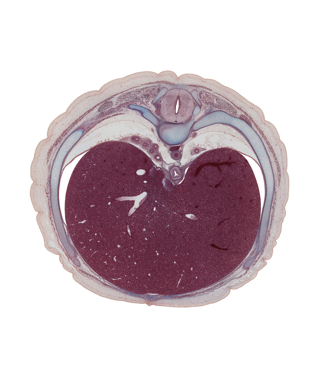 T-8 / T-9 interganglion region, T-8 / T-9 intervertebral disc, anterior gastric nerve (CN X), caudal edge of left lung, central canal of spinal cord, diaphragm, dorsal horn of grey matter, ductus venosus, efferent hepatic vein, esophageal hiatus in diaphragm, head of rib 9, iliocostalis muscle, inferior vena cava, left hepatic vein tributary (revehente vein), longissimus muscle, muscular part of diaphragm, neural arch, peritoneal cavity, posterior gastric nerve (CN X), rib 9, right hepatic vein, sympathetic trunk, transversospinalis muscle