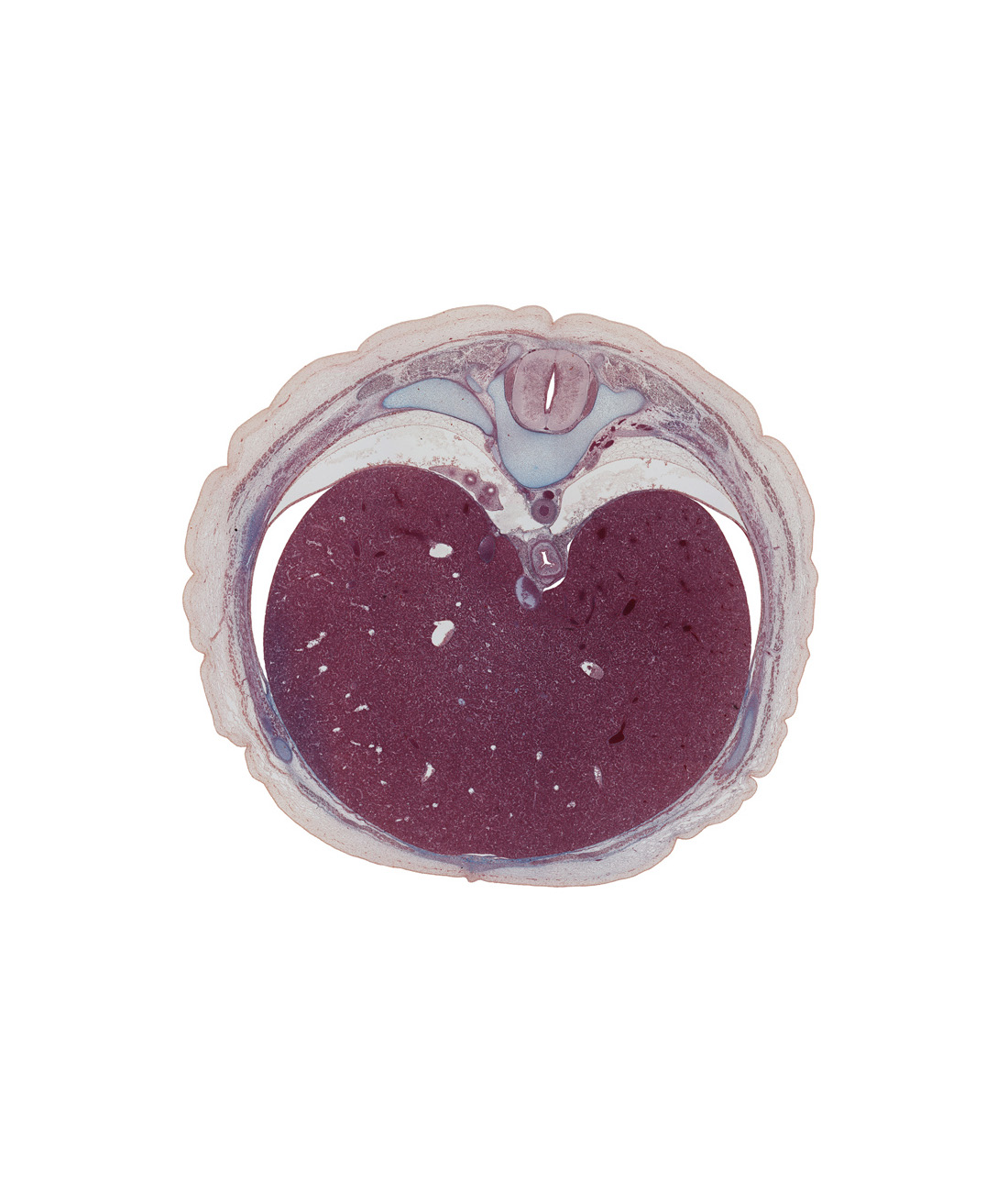 T-9 rib (costal cartilage), T-9 spinal ganglion, aorta, central canal, diaphragm, dorsal funiculus, ductus venosus, efferent hepatic vein, esophagus, inferior hemi-azygos vein, inferior vena cava, lateral funiculus, left lobe of liver, lower lobe of right lung, pleural recess, right lobe of liver, sympathetic trunk, transverse process, ventral funiculus