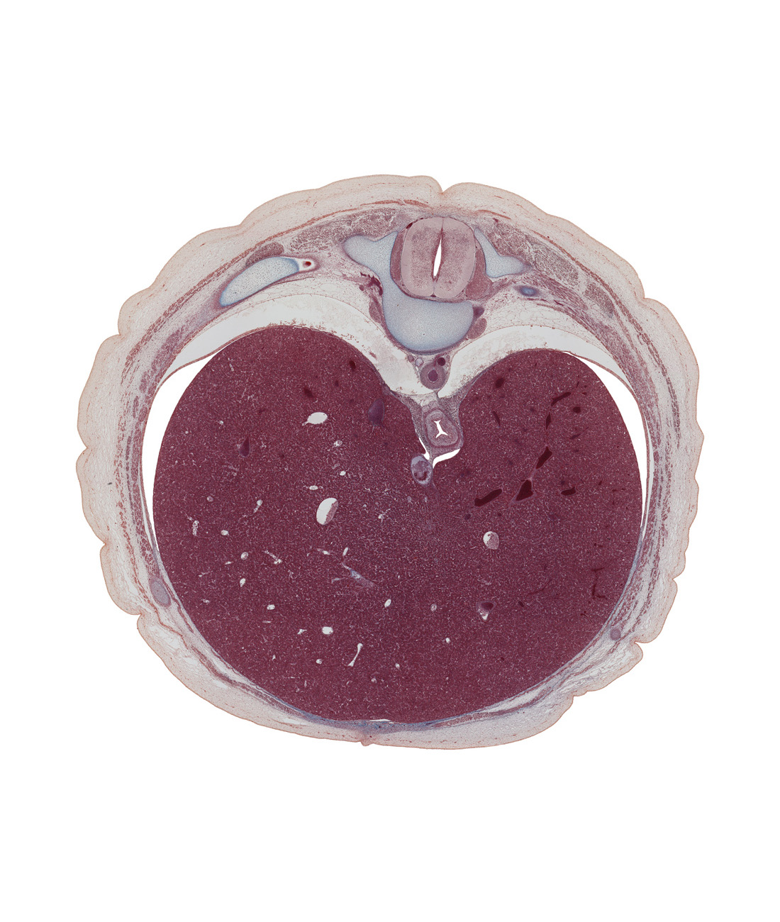 T-9 spinal ganglion, aorta, costal margin, diaphragm, dorsal meso-esophagus, dorsal primary ramus, ductus venosus, efferent hepatic vein, external abdominal oblique muscle, external intercostal muscle(s), inferior vena cava, internal intercostal muscle(s), left lobe of liver, peritoneal cavity, pleural recess, right lobe of liver, ventral meso-esophagus