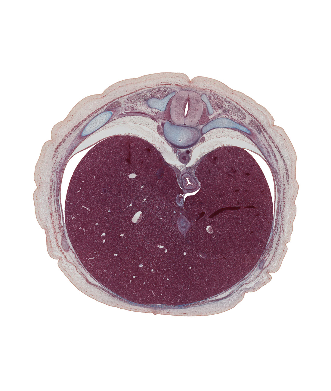 T-9 spinal ganglion, aorta, aponeurosis of external abdominal oblique muscle, caudal part of serratus anterior muscle, dorsal primary ramus, ductus venosus, efferent hepatic vein, esophagus, inferior vena cava, latissimus dorsi muscle, left lobe of liver, normal spina bifida occulta, notochord, rib 10, right lobe of liver, sympathetic trunk, trapezius muscle