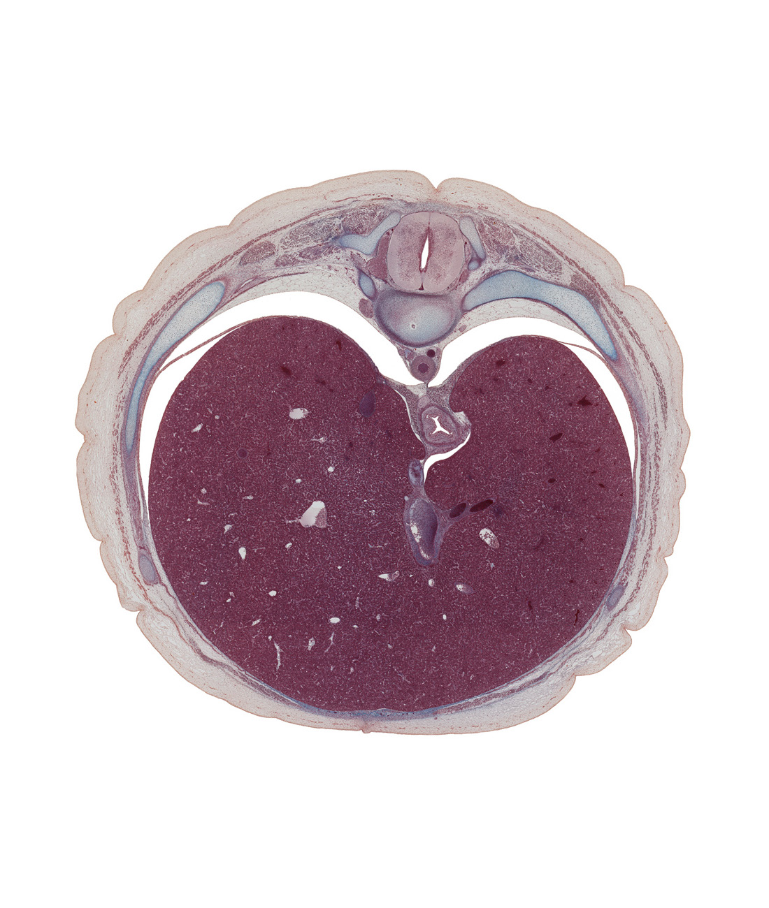 T-9 / T-10 intervertebral disc, T-9 spinal ganglion, aorta, costal margin, diaphragm, dorsal meso-esophagus, ductus venosus, efferent hepatic vein, esophagus, inferior hemi-azygos vein, inferior vena cava, left lobe of liver, neural arch, notochord, pleural recess, rib 10, right lobe of liver, transverse process, ventral meso-esophagus