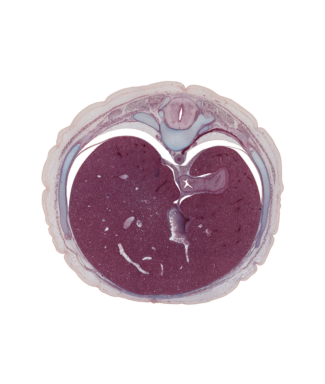 T-10 spinal ganglion, abdominal part of esophagus, advehente vein, aorta, aponeurosis of external abdominal oblique muscle, branch of hepatic portal vein, central canal, costal margin, costovertebral joint, dorsal horn of grey matter, ductus venosus, fundus of stomach, greater sac, lateral horn of grey matter, left lobe of liver, lesser omentum (ventral mesogastrium), muscular part of diaphragm, peritoneal cavity, pleural recess, posterior intercostal vein, rectus abdominis muscle, rib 10, right lobe of liver, ventral horn of grey matter