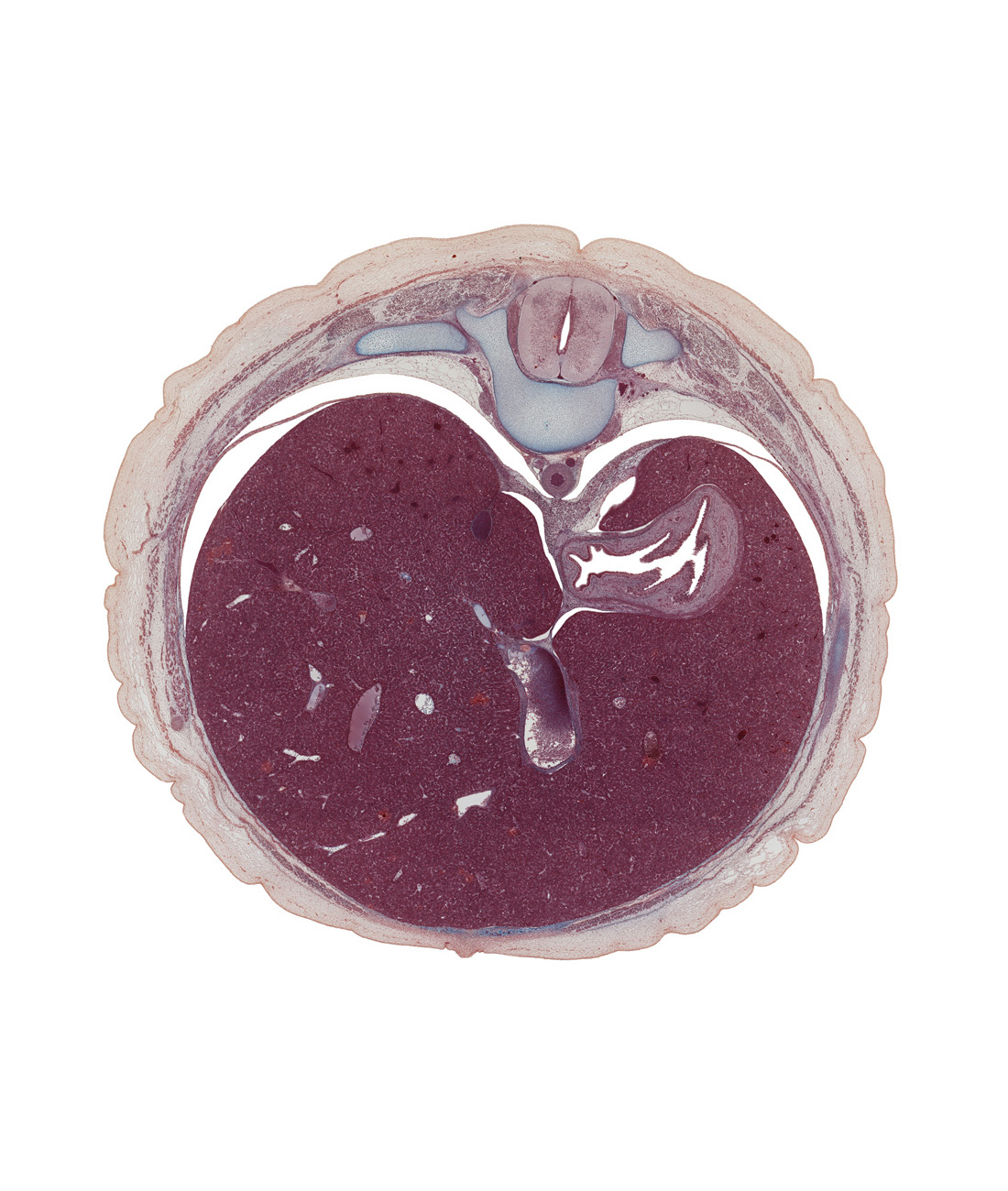 T-10 spinal ganglion, T-10 spinal nerve, afferent hepatic vein, aorta, cardiac orifice, diaphragm, ductus venosus, fundus of stomach, greater sac, inferior vena cava, internal abdominal oblique muscle, left lobe of liver, lesser splanchnic nerve, pleural recess, right lobe of liver, sympathetic trunk, ventral mesogastrium (lesser omentum)