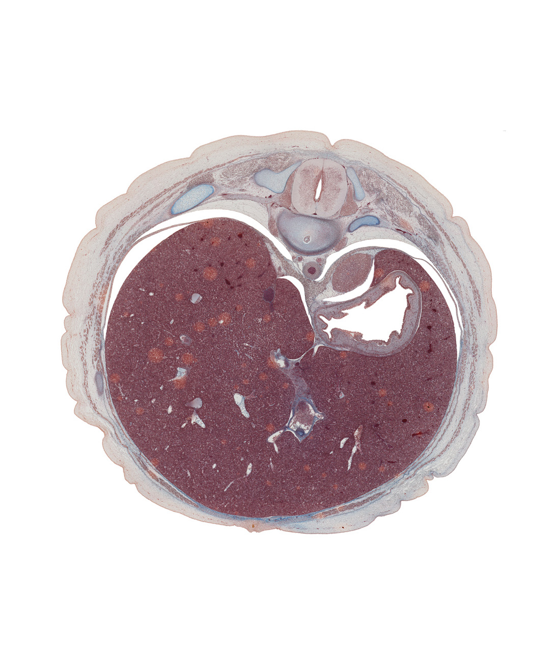 T-10 / T-11 intervertebral disc, T-10 intercostal nerve, T-10 spinal ganglion, aorta, central canal, dorsal mesogastrium, ductus venosus, greater sac, greater splanchnic nerve, head of rib 11, inferior vena cava, latissimus dorsi muscle, left lobe of liver, notochord, ramus communicans, right lobe of liver, suprarenal gland, sympathetic trunk, ventral mesogastrium (lesser omentum)