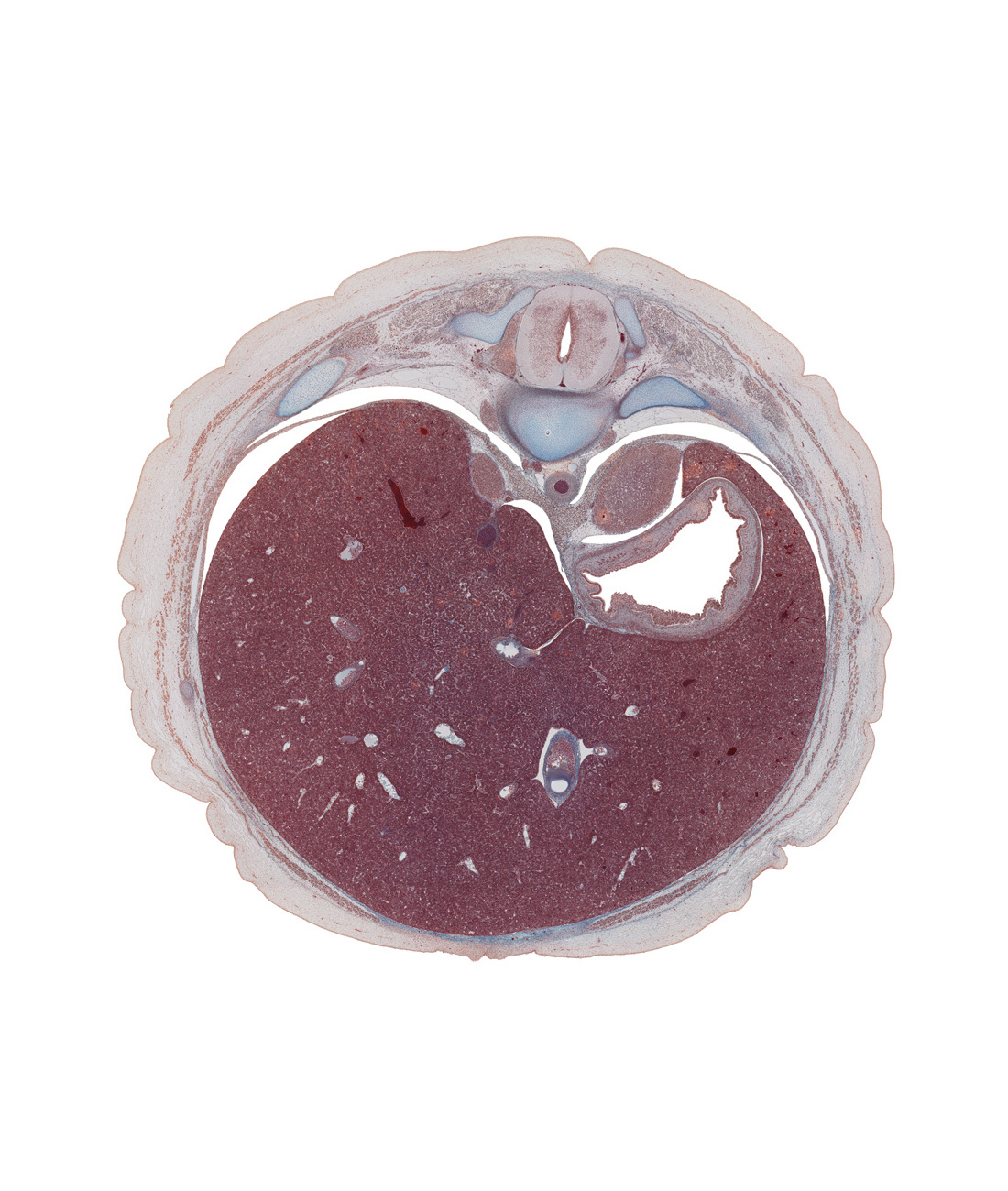 T-10 spinal ganglion, anterior spinal artery, anterior wall of stomach, aorta, cephalic edge of suprarenal gland cortex, diaphragm, diaphragmatic recess of pleural cavity, dorsal mesogastrium, ductus venosus, external abdominal oblique muscle, future fusion region of peritoneal cavity, head of rib 11, inferior vena cava, left lobe of liver, normal spina bifida occulta, peritoneal cavity, pleural recess, right lobe of liver, suprarenal gland cortex, sympathetic trunk