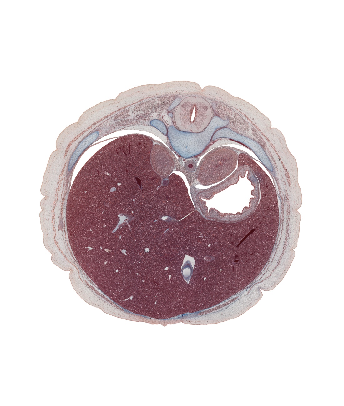 T-10 / T-11 interganglion region, anterior rectus sheath, aorta, diaphragm, dorsal mesogastrium, ductus venosus, greater sac, inferior vena cava, left lobe of liver, lumen of body of stomach, pleural recess, rectus abdominis muscle, rib 11, right crus of diaphragm, right lobe of liver, suprarenal gland, sympathetic trunk
