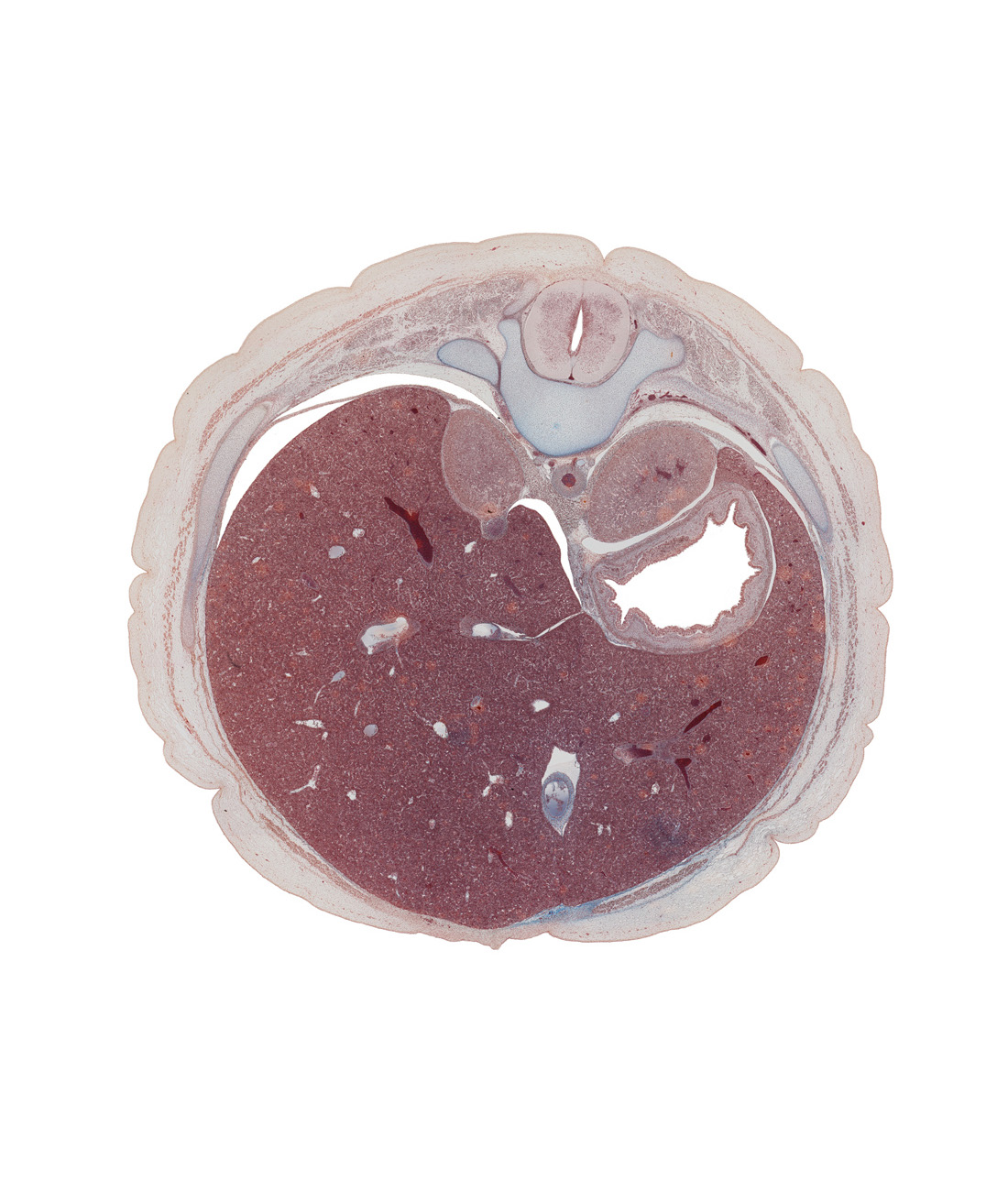 T-10 / T-11 interganglion region, T-11 intercostal nerve, afferent hepatic vein, aorta, body of stomach, costovertebral joint, diaphragm, dorsal mesogastrium, ductus venosus, gastric fold(s), inferior vena cava, left lobe of liver, liver prominence, notochord, pedicle, rib 11, right crus of diaphragm, right lobe of liver, suprarenal gland, sympathetic trunk