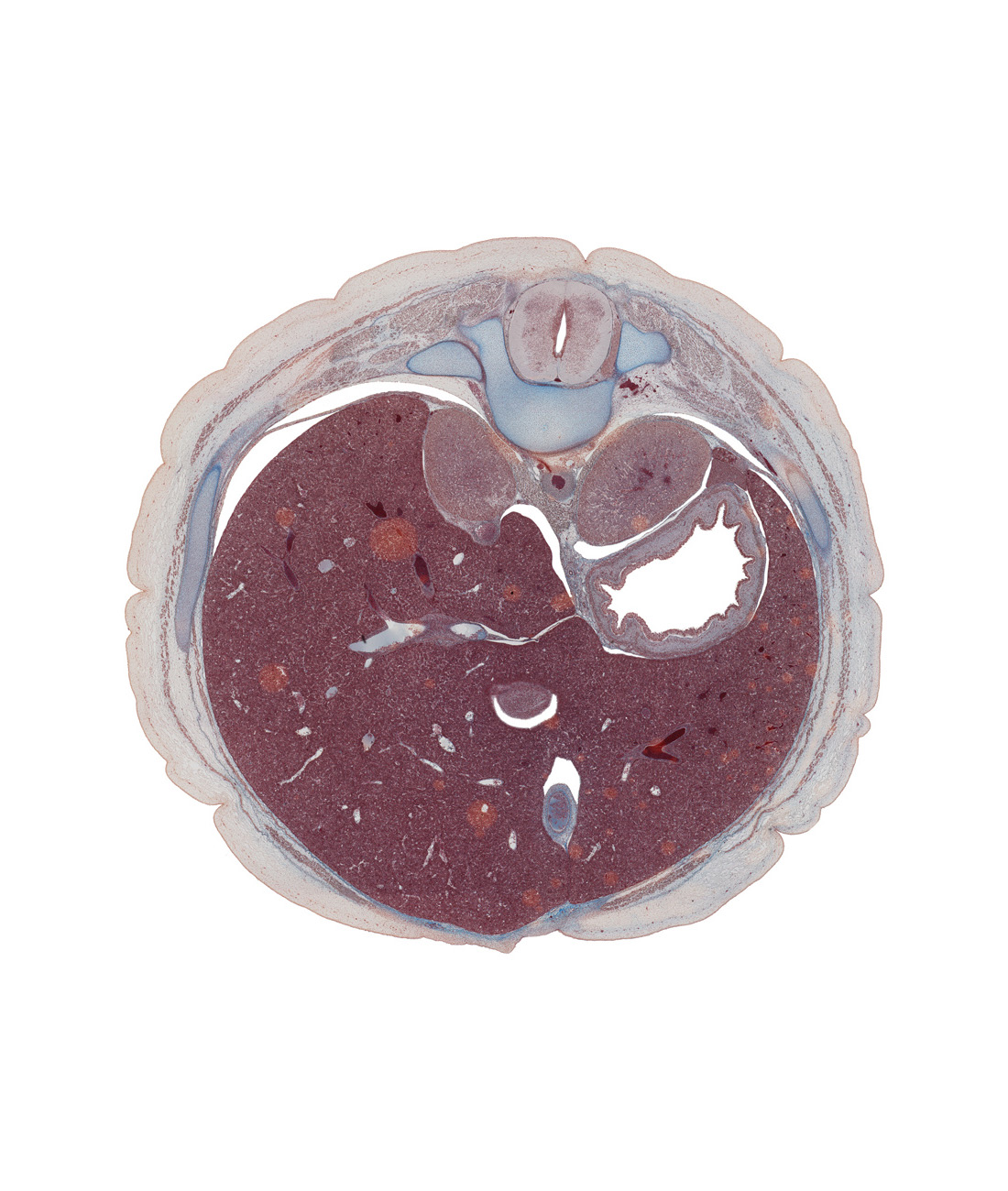 T-11 spinal ganglion, advehente vein, anterior rectus sheath, anterior wall of stomach, aorta, cephalic edge of duodenum, dorsal mesogastrium, ductus venosus, future fusion region of peritoneal cavity, gastric fold(s), iliocostalis muscle, inferior vena cava, latissimus dorsi muscle, left lobe of liver, linea alba, longissimus muscle, ramus of lesser splanchnic nerve, rectus abdominis muscle, rib 11, right lobe of liver, spinalis muscle, spleen, suprarenal gland, transversospinalis muscle
