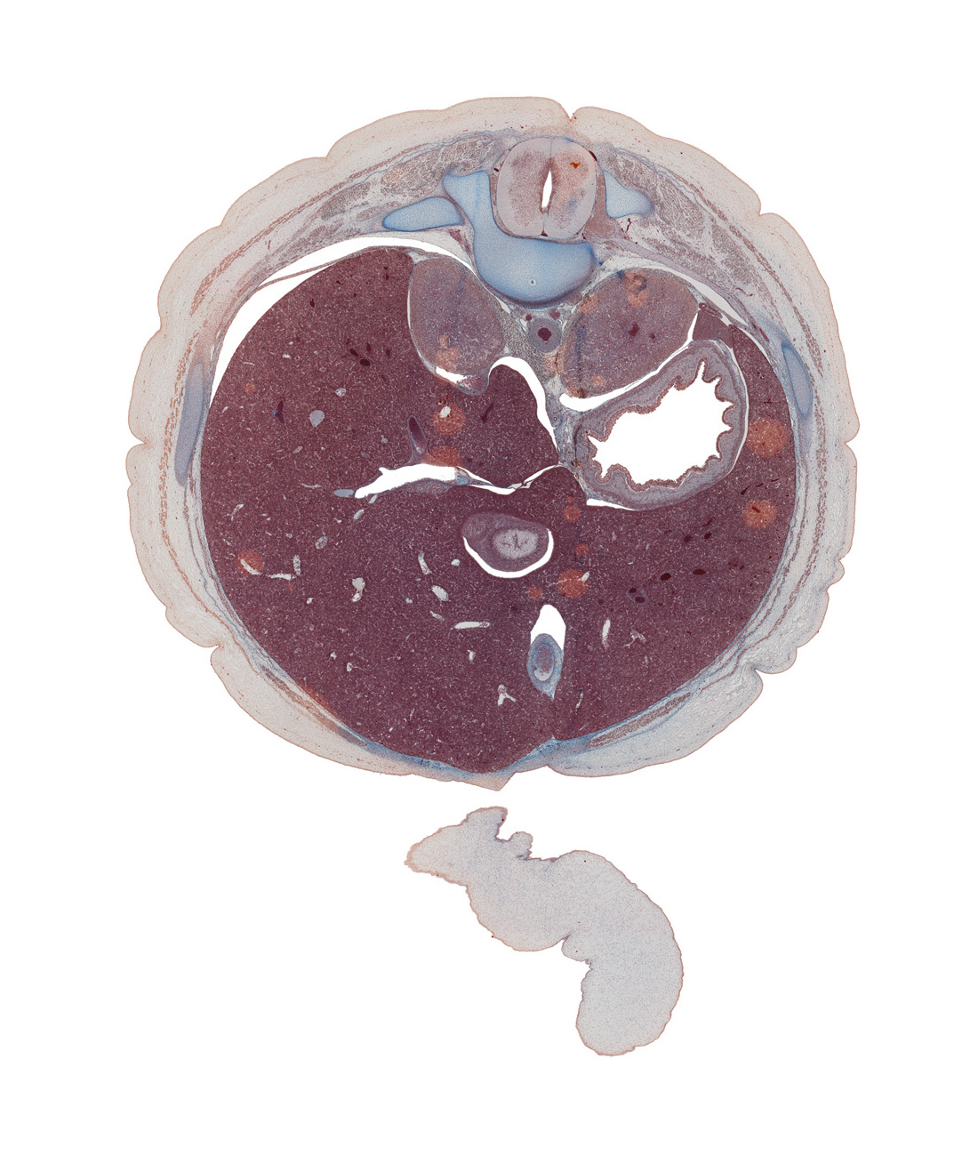T-11 intercostal nerve, T-11 spinal ganglion, amnion, anterior wall of stomach, aorta, central canal, cephalic edge of umbilical cord, cephalic part of pyloric antrum of stomach, diaphragm, dorsal horn of grey matter, dorsal mesogastrium, ductus venosus, hepatic portal vein, inferior vena cava, internal abdominal oblique muscle, lateral horn of grey matter, left lobe of liver, mucoid connective tissue, peritoneal cavity, pleural recess, rib 11, right lobe of liver, suprarenal gland, transversus abdominis muscle, ventral horn of grey matter
