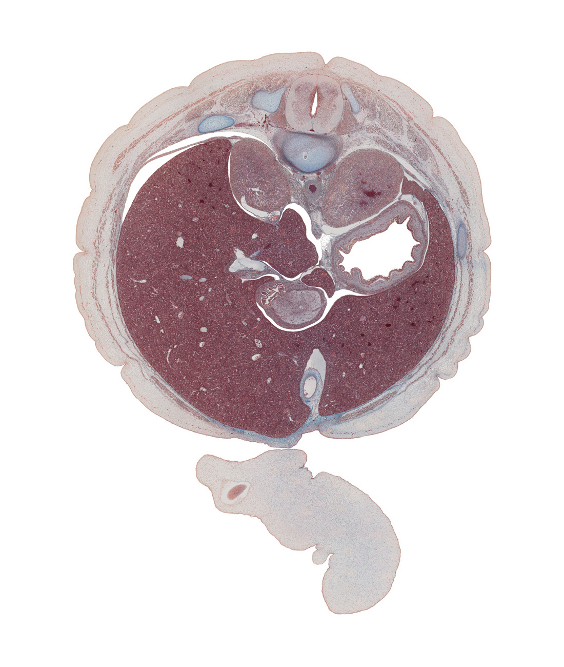 T-11 spinal ganglion, aorta, body of stomach, dorsal mesoduodenum, dorsal mesogastrium, ductus venosus, edge of herniated intestines, edge of umbilical coelom, epiploic foramen, falciform ligament, greater sac, hepatic portal vein, inferior vena cava, left lobe of liver, lesser curvature of stomach, lesser splanchnic nerve, notochord remnant, pylorus of stomach, rib 11, right crus of diaphragm, right lobe of liver, spleen, superior part of duodenum, suprarenal gland, umbilical cord