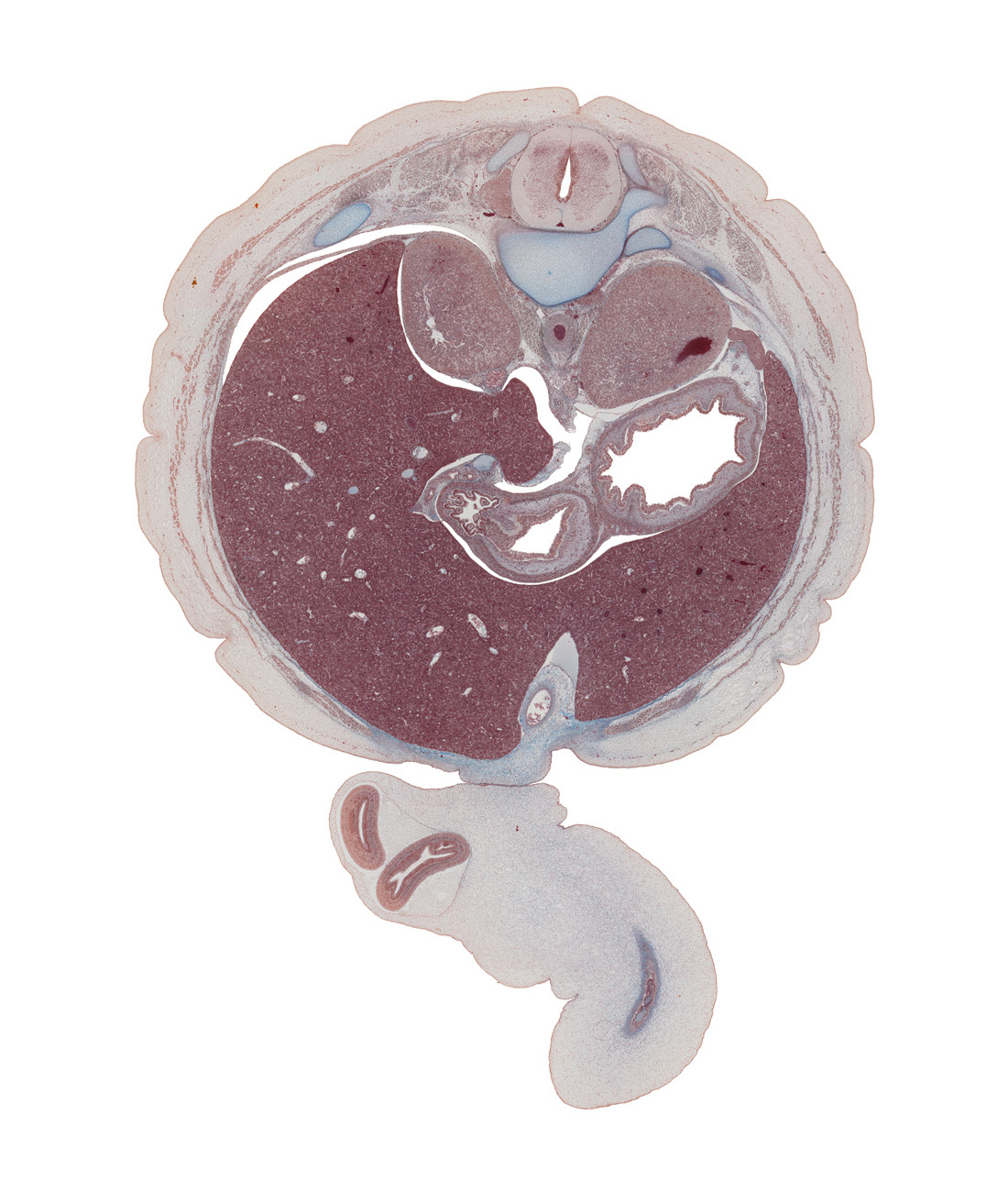 T-11 / T-12 interganglion region, amnion, anterior spinal artery, anterior wall of stomach, aorta, bile duct, caudal edge of pleural recess, caudate lobe of liver, central canal, diaphragm, dorsal mesogastrium, edge of umbilical vein, head of rib 12, hepatic portal vein, herniated intestines, iliocostalis muscle, inferior vena cava, lesser sac (omental bursa), longissimus muscle, lumen of body of stomach, mucoid connective tissue, posterior wall of stomach, pyloric antrum of stomach, pylorus of stomach, spinalis muscle, spleen, superior part of duodenum, suprarenal gland cortex, transversospinalis muscle, umbilical coelom, umbilical cord, umbilical vein