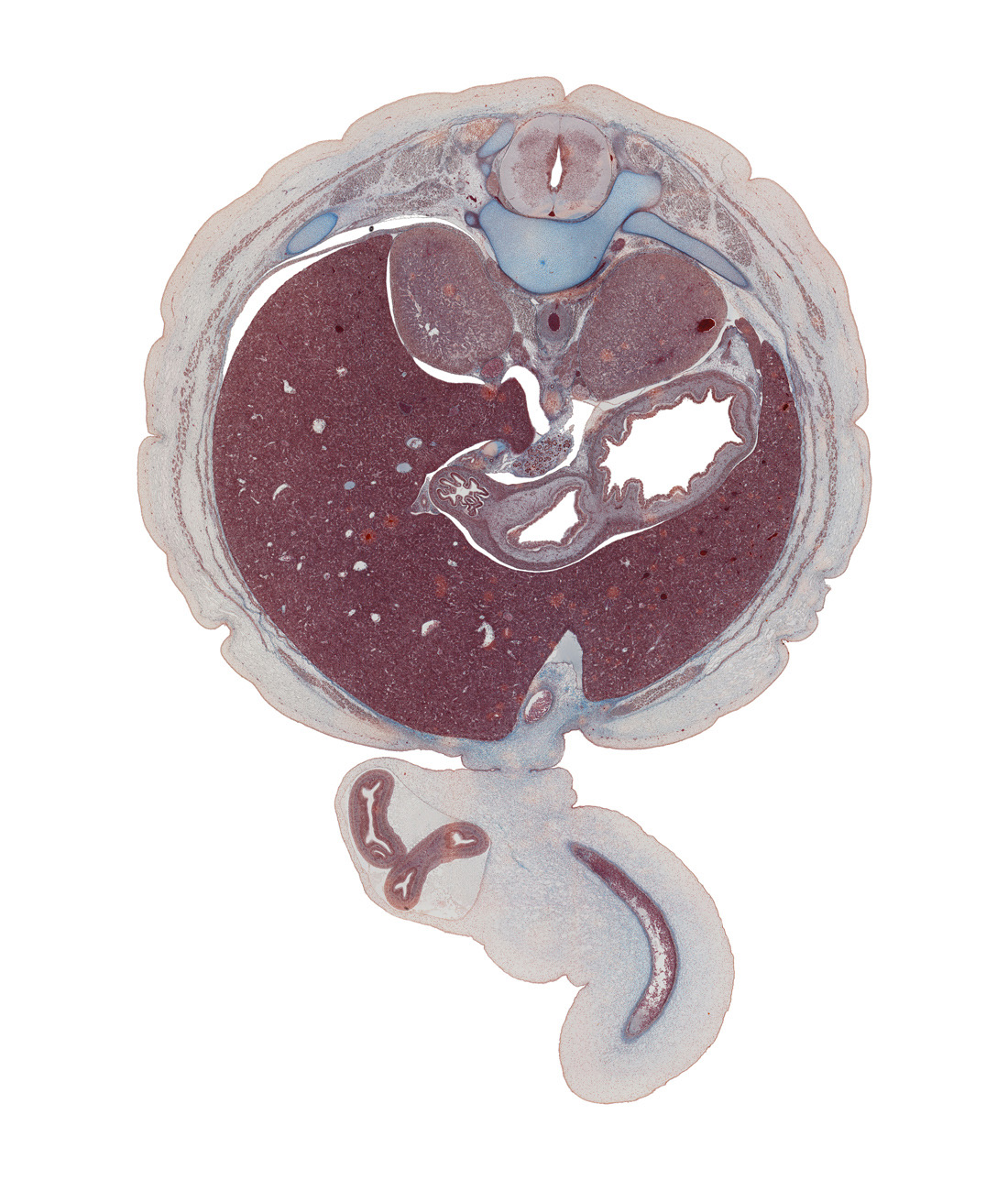 T-11 / T-12 interganglion region, aorta, body of stomach, dorsal mesoduodenum, falciform ligament, greater sac, head of ventral pancreas, hepatic and cystic ducts, hepatic portal vein, herniated intestines, inferior vena cava, left crus of diaphragm, left lobe of liver, notochord, pyloric antrum of stomach, rib 12, right crus of diaphragm, right lobe of liver, spleen, suprarenal gland, sympathetic trunk, umbilical coelom, umbilical cord, umbilical vein