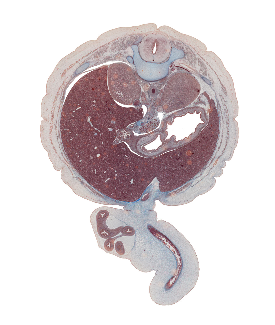 T-11 / T-12 interganglion region, aorta, caudate lobe of liver, centrum of T-12 vertebra, cystic duct, descending part of duodenum, dorsal mesogastrium, falciform ligament, gastric fold(s), head of ventral pancreas, hepatic portal vein, herniated intestines, inferior vena cava, left lobe of liver, neural arch, notochord, pyloric antrum of stomach, rib 12, right lobe of liver, spleen, suprarenal gland cortex, suprarenal impression of liver, umbilical coelom, umbilical cord, umbilical vein
