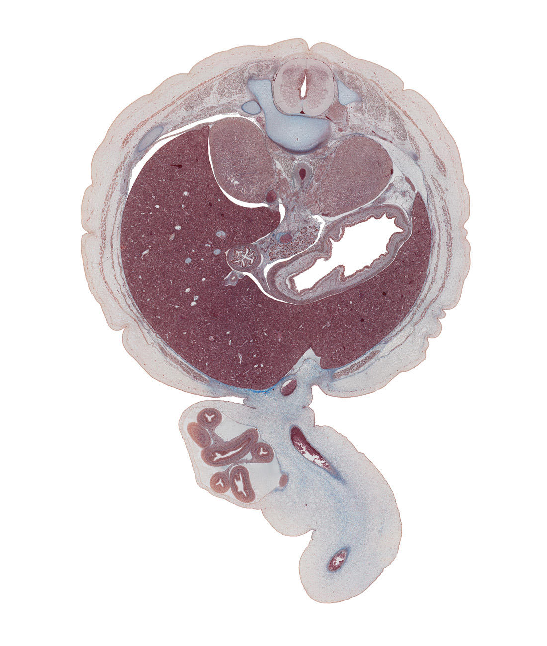 T-12 spinal ganglion, aorta, body of stomach, caudal edge of spleen, cystic duct, descending part of duodenum, dorsal mesoduodenum, falciform ligament, head of ventral pancreas, herniated intestines, inferior vena cava, lesser sac (omental bursa), origin of celiac artery, pyloric antrum of stomach, rectus abdominis muscle, splenic artery, superior mesenteric vein, suprarenal gland cortex, umbilical coelom, umbilical cord, umbilical vein