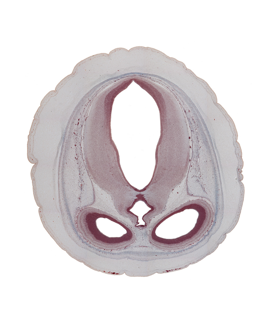 cerebral aqueduct (mesocoele), cortical plate, dural limiting membrane, habenular region, hypothalamic sulcus, intermediate zone, lateral ventricle, marginal zone, mesencephalic arteries in pia mater, mesencephalon, osteogenic layer, superior colliculus region, superior sagittal sinus, third ventricle, venous plexus(es), ventricular zone